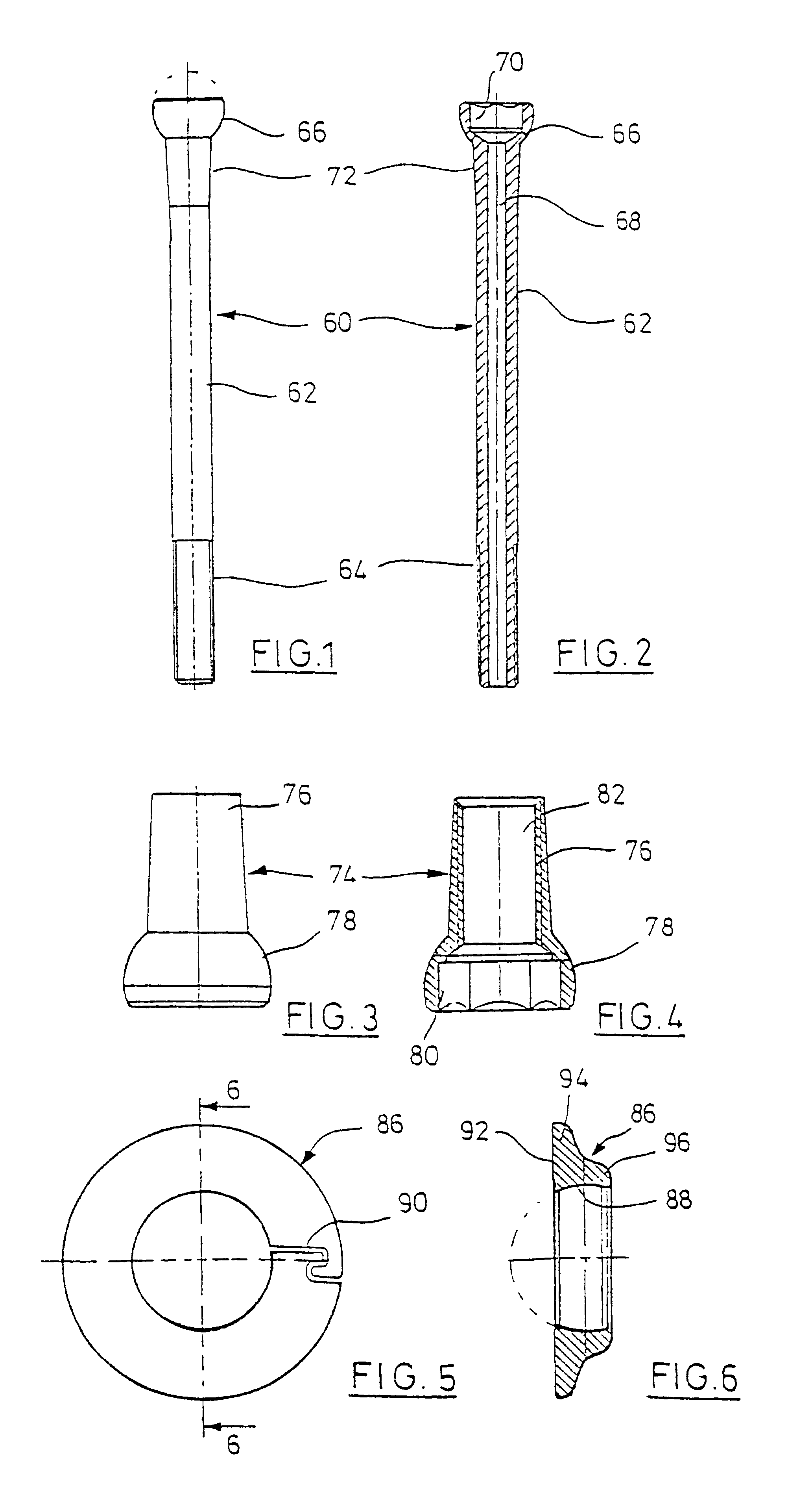 Condylus screw