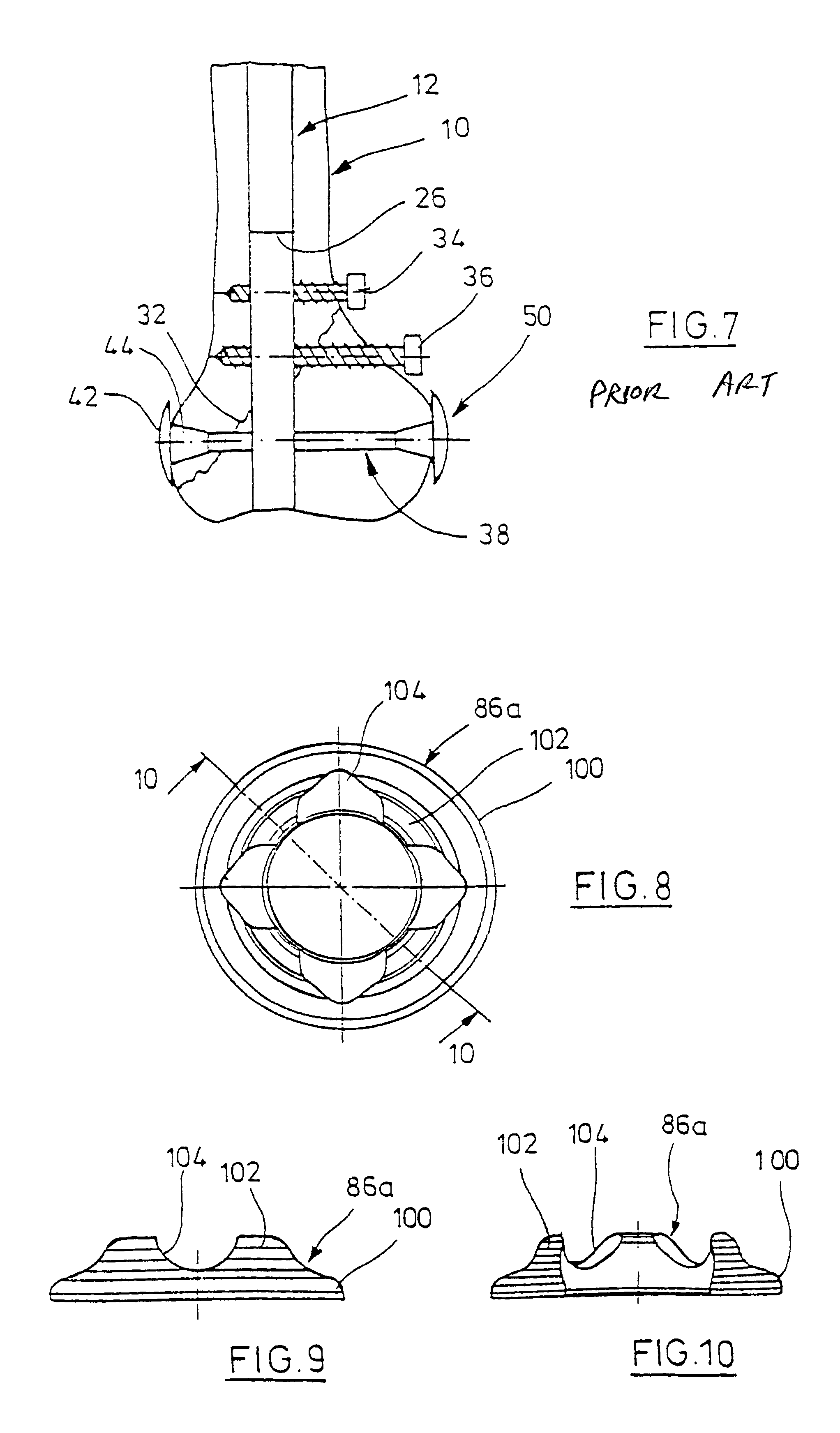 Condylus screw