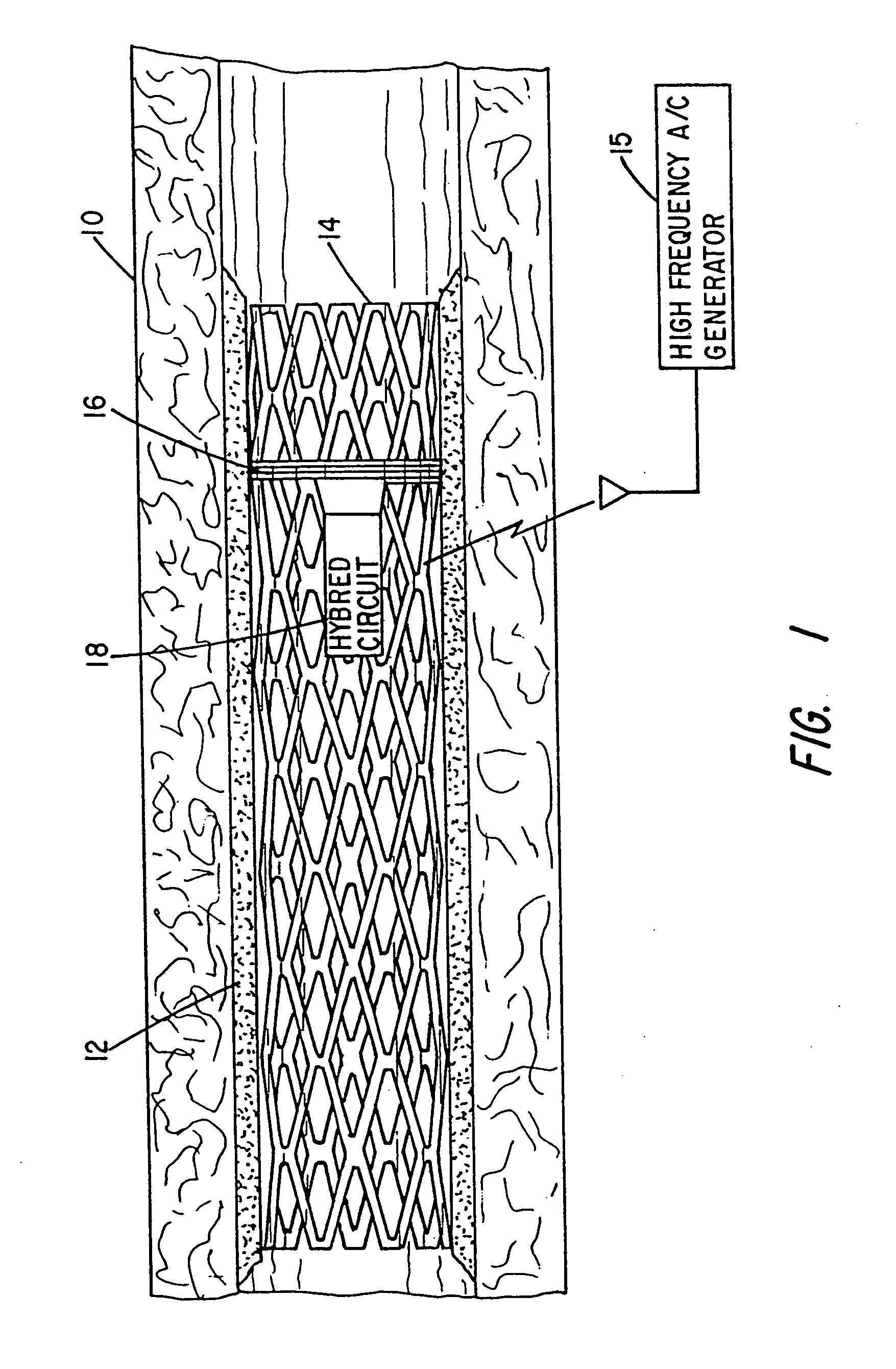 Implantable device for promoting repair of a body lumen