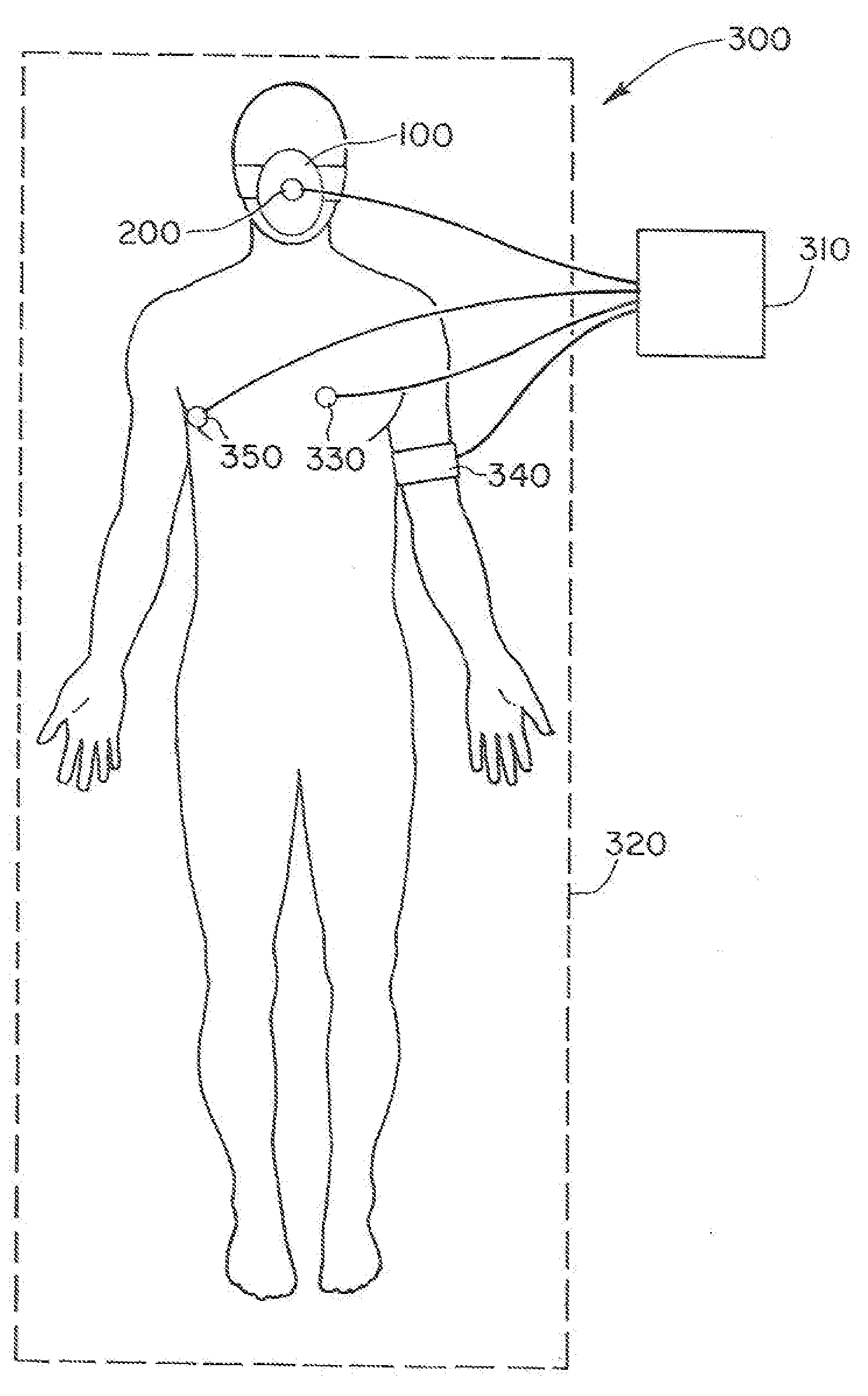 System for sensing, diagnosing and treating physiological conditions and methods