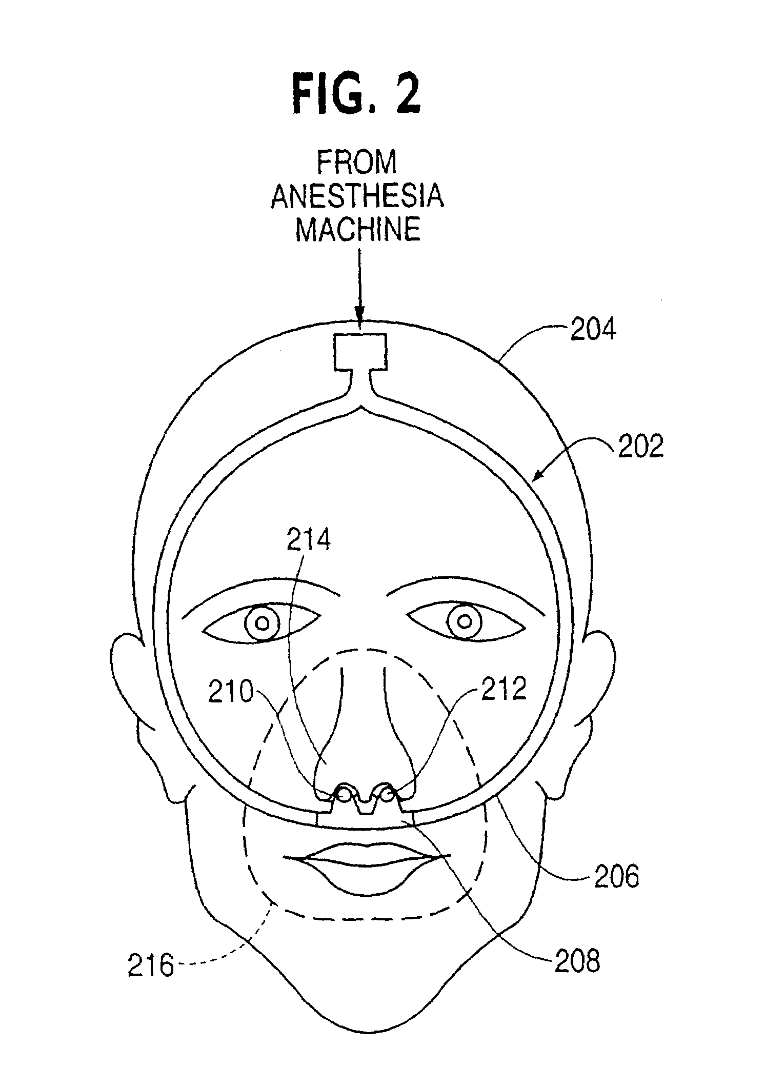 Nasal gas delivery system and method for use thereof