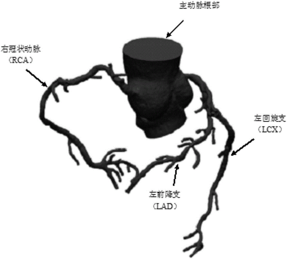 Method for computing FFR&lt;CT&gt; (fractional flow reserve &lt;computed tomography&gt;) on basis of personalized coronary artery branch blood flow volumes