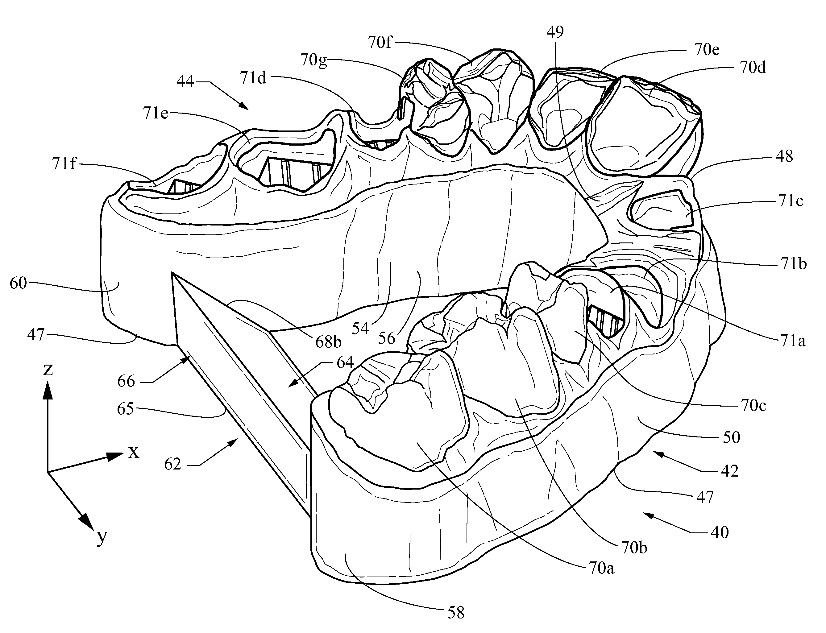 Dental arch model and method of making the same