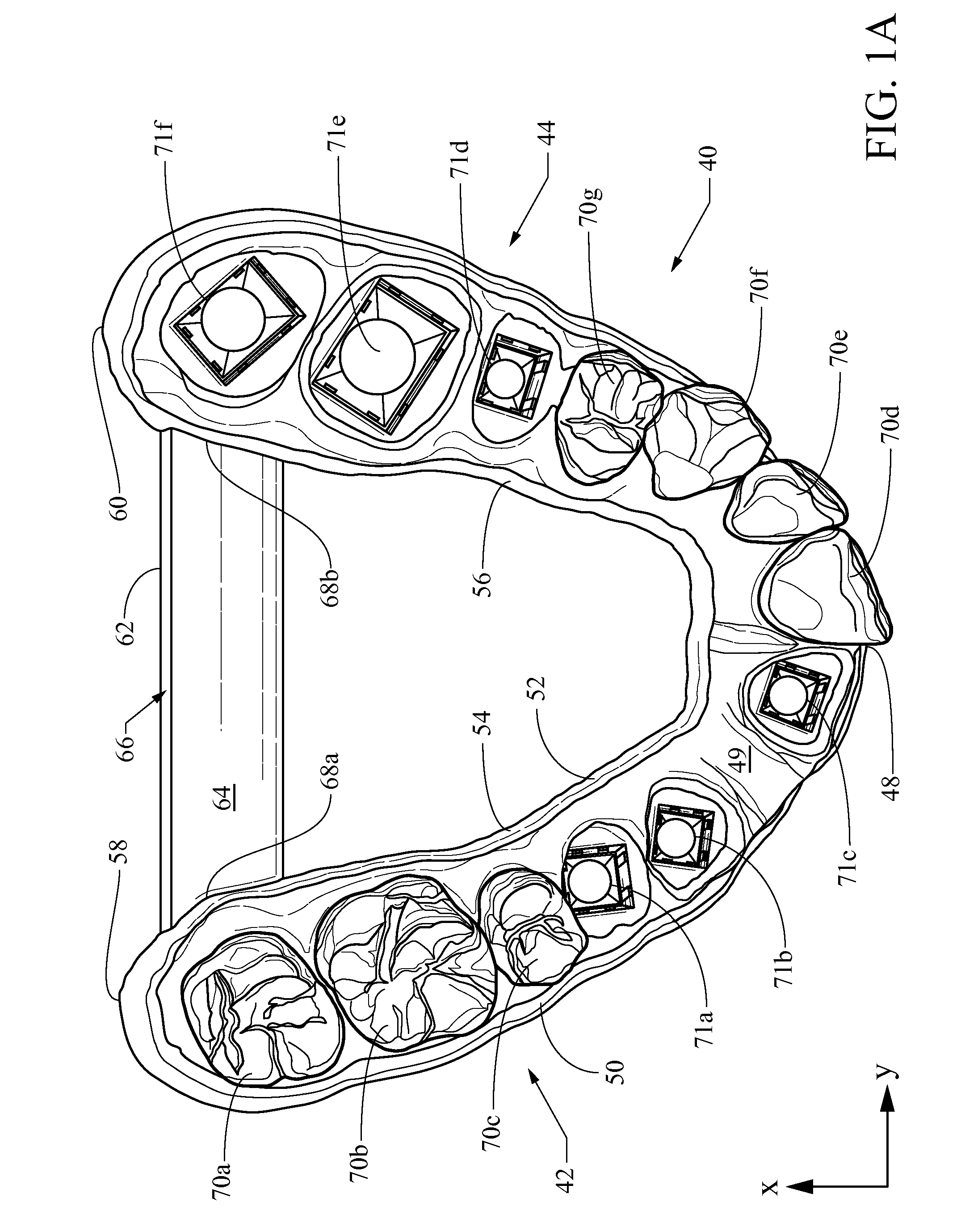 Dental arch model and method of making the same