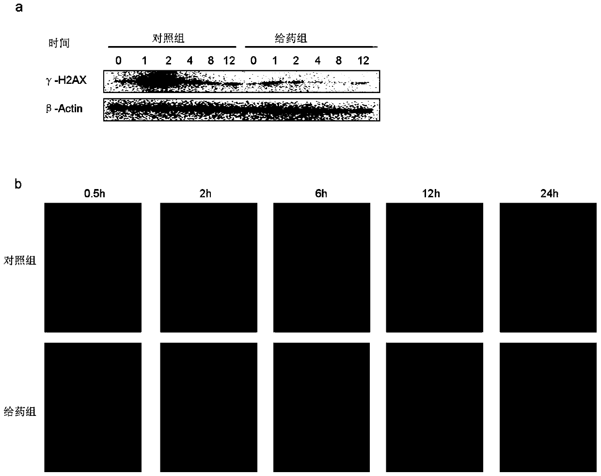 Application of cordycepin in preparation of medicine for preventing and/or treating radiation damage