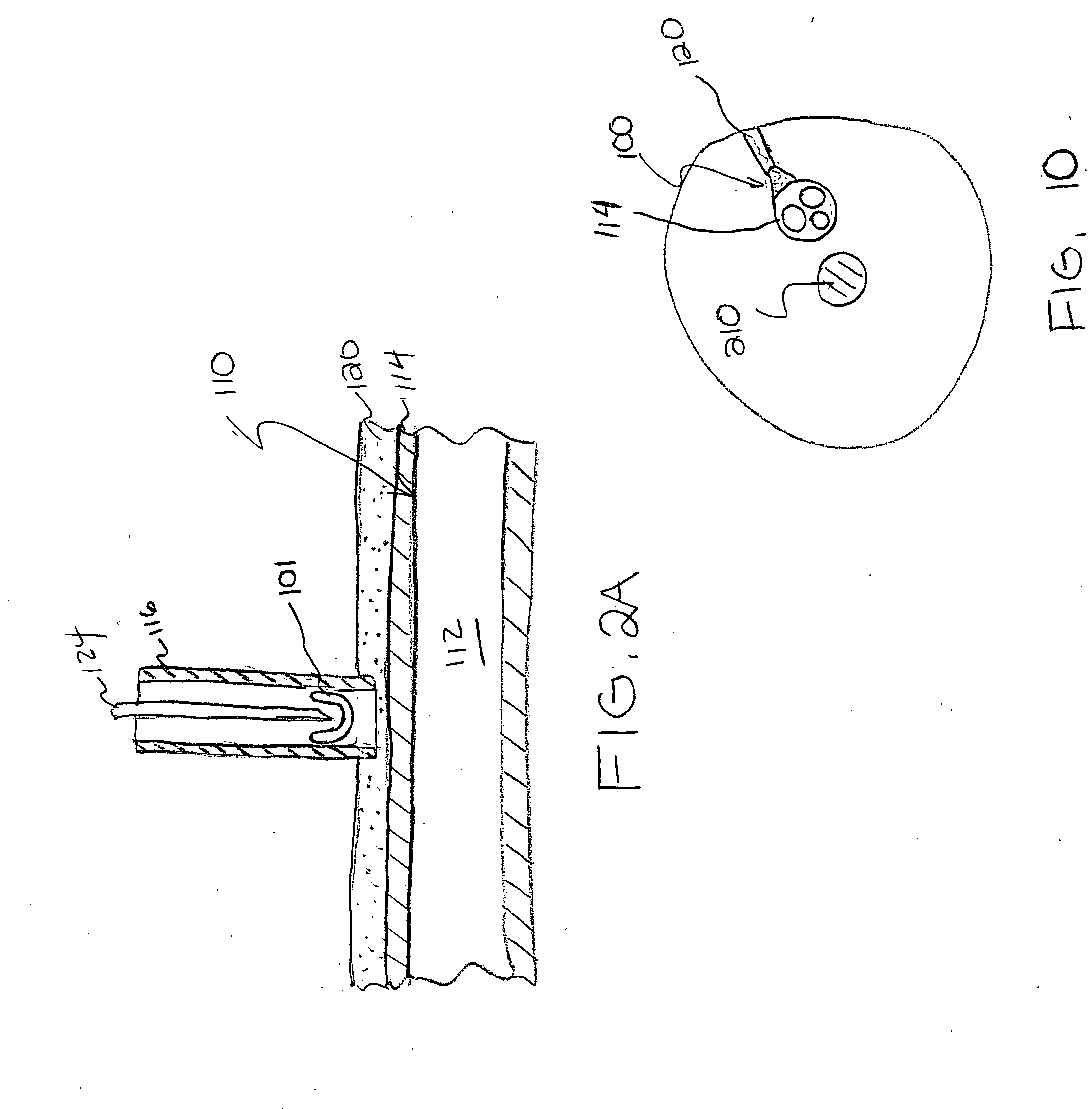 Device and method for closing an opening in a body cavity or lumen