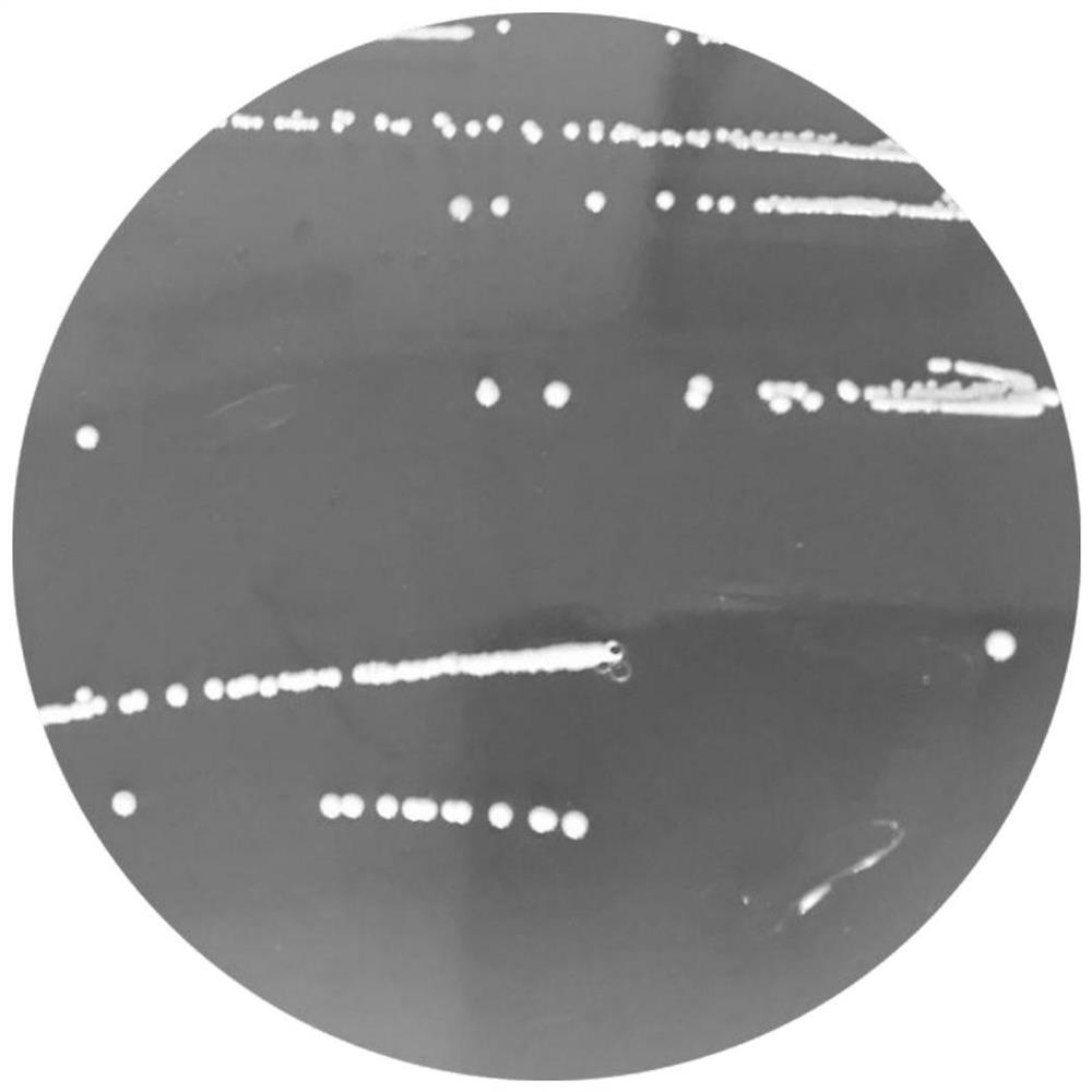 Bifidobacterium longum NX-4 and application thereof in preparing drugs for treating and/or preventing allergic diseases