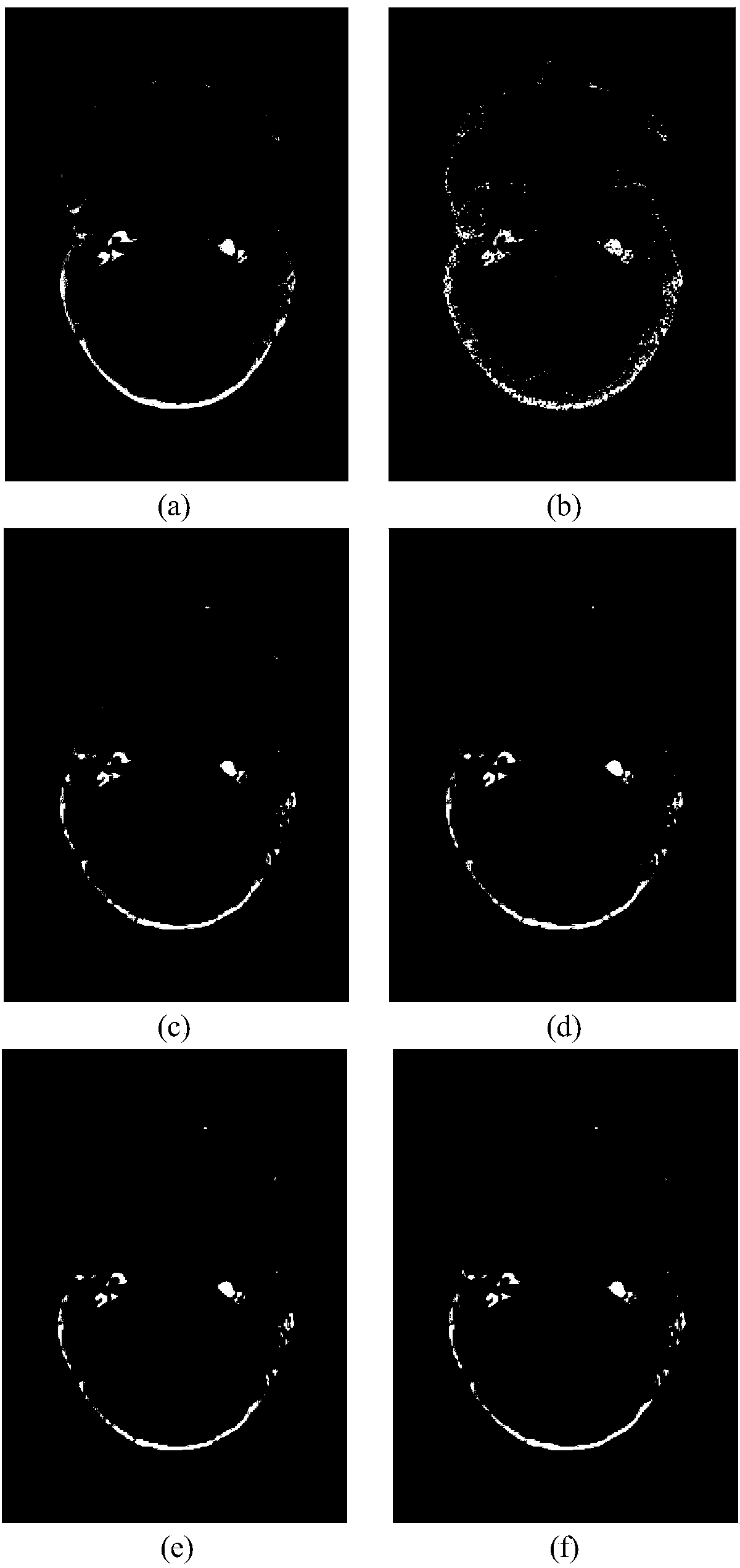 Medical image noise reduction method based on structure clustering and sparse dictionary learning