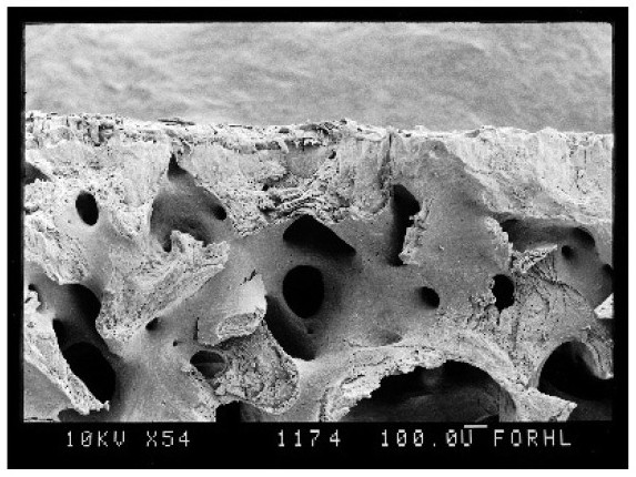 Injectable temperature-sensitive hydrogel capable of treating osteoarthritis