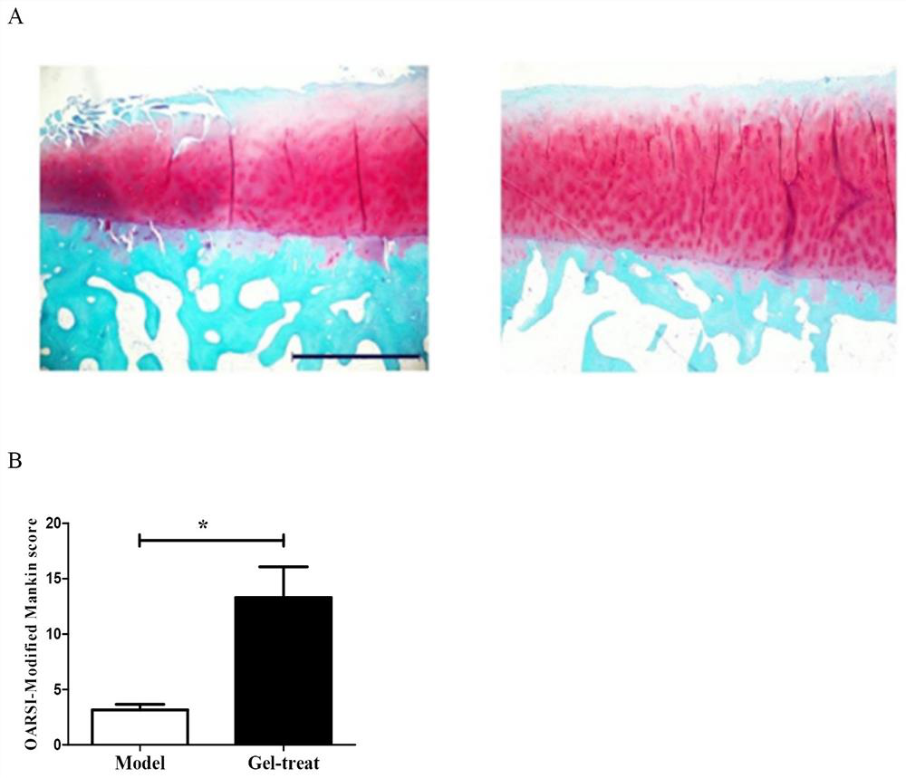 Injectable temperature-sensitive hydrogel capable of treating osteoarthritis