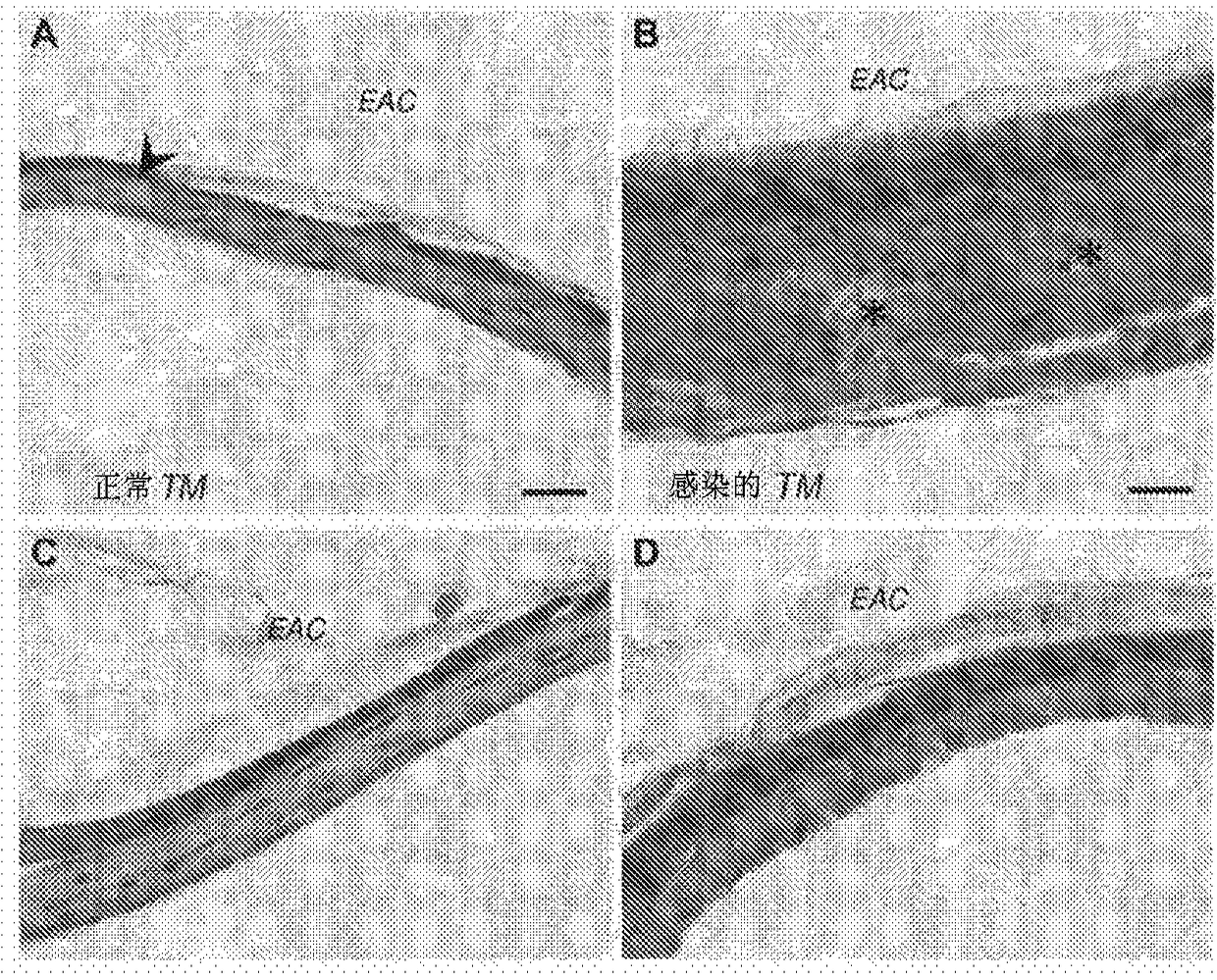 Compositions with permeation enhancers for drug delivery