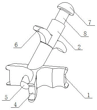 Locating massage treatment device for pelma opisthencephalon reflecting region