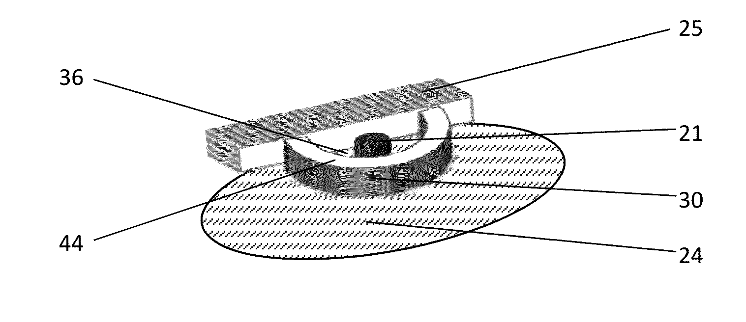 Containment devices for treatment of intestinal fistulas and complex wounds