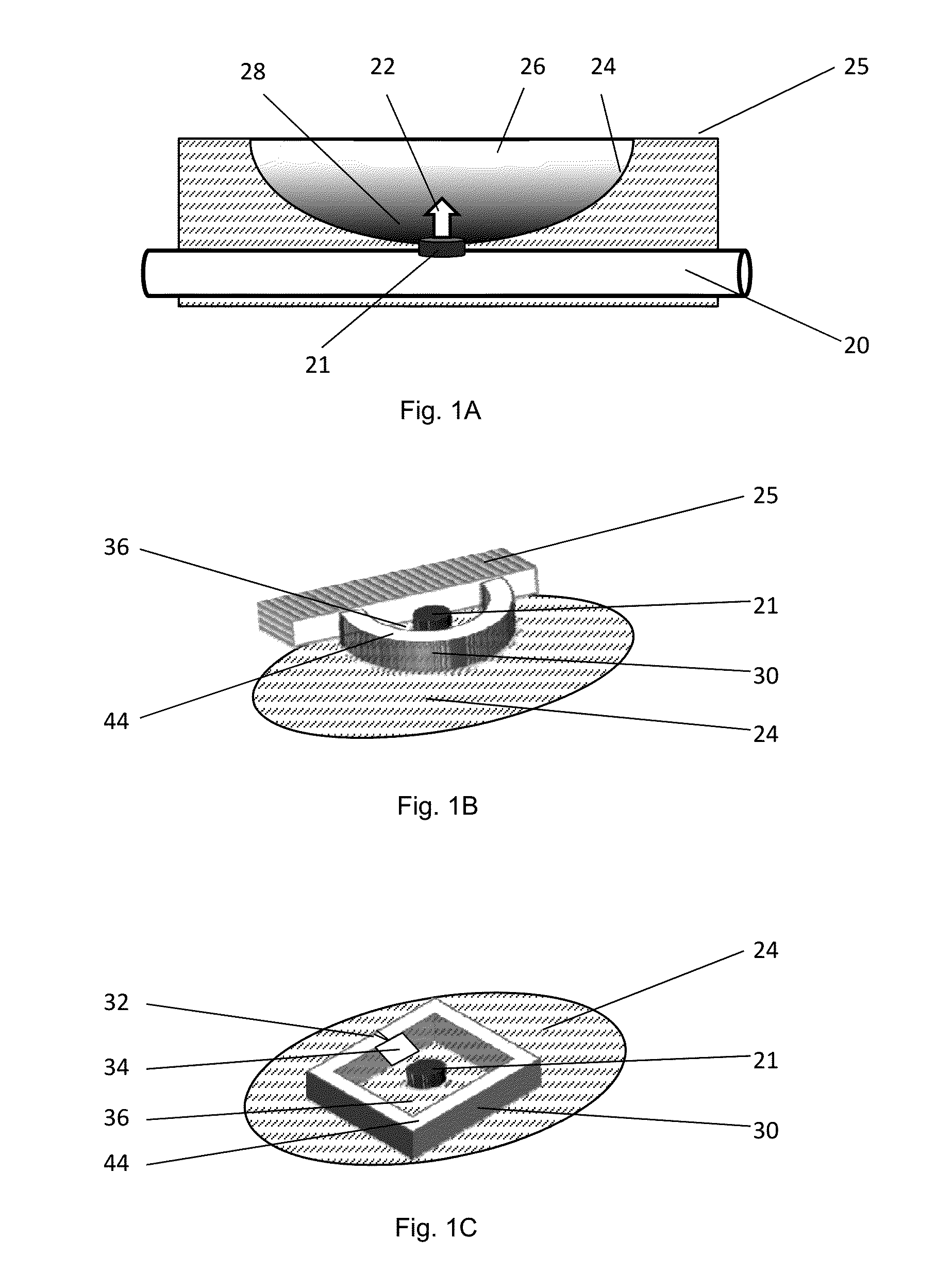 Containment devices for treatment of intestinal fistulas and complex wounds