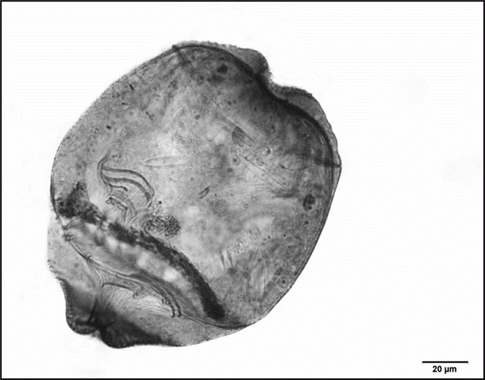 Staining method of ciliates