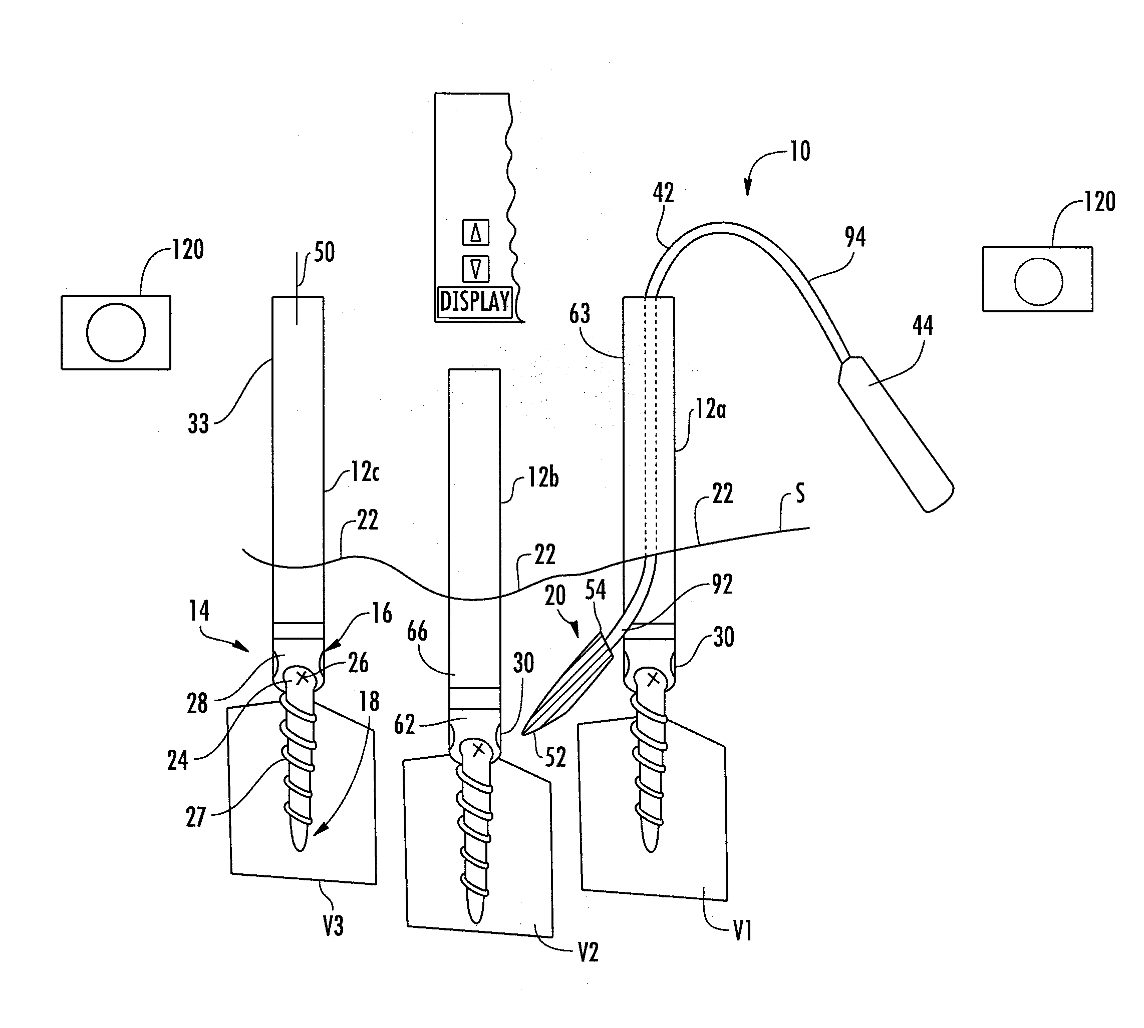 Method And Apparatus For Facilitating Navigation Of An Implant