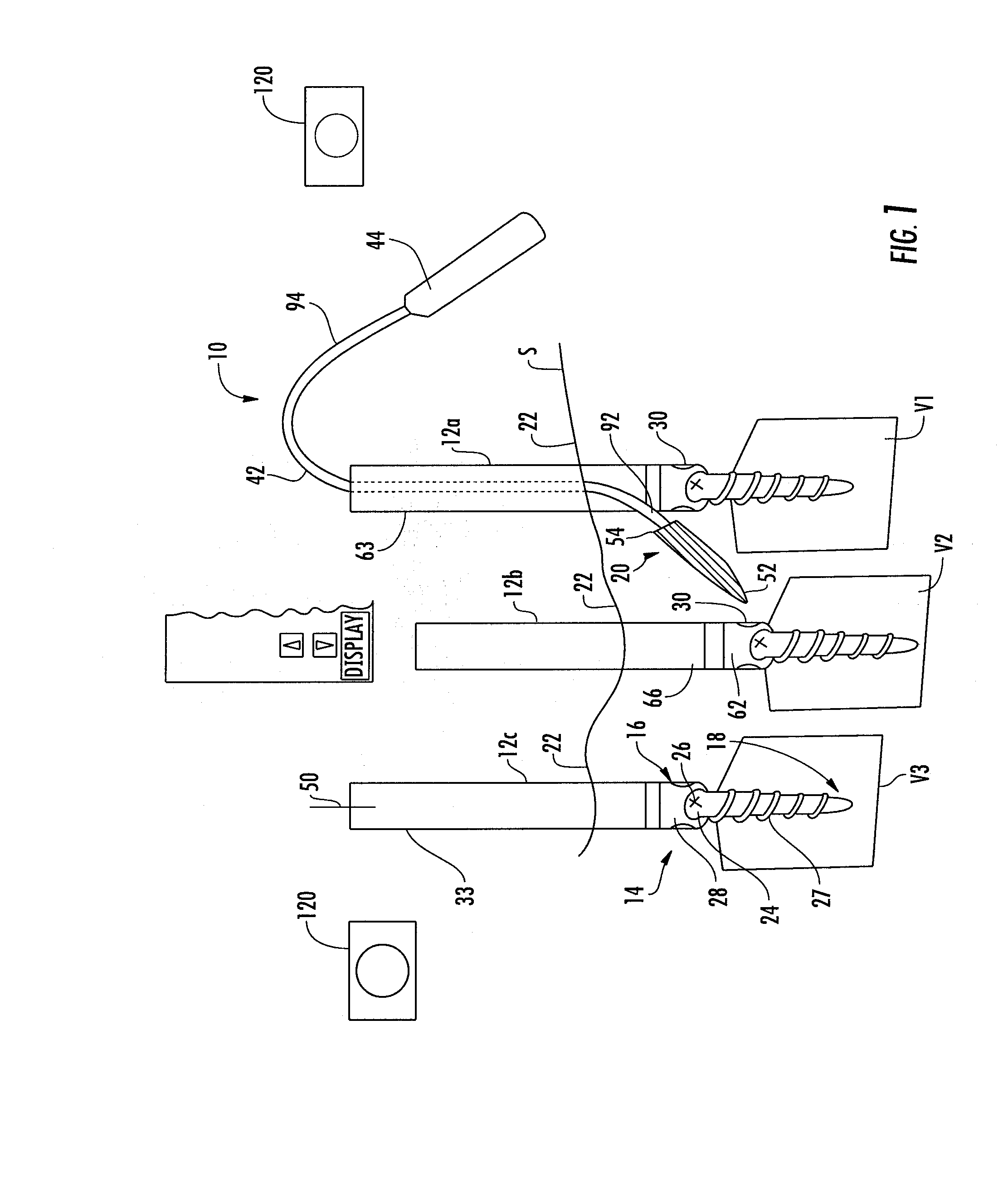 Method And Apparatus For Facilitating Navigation Of An Implant