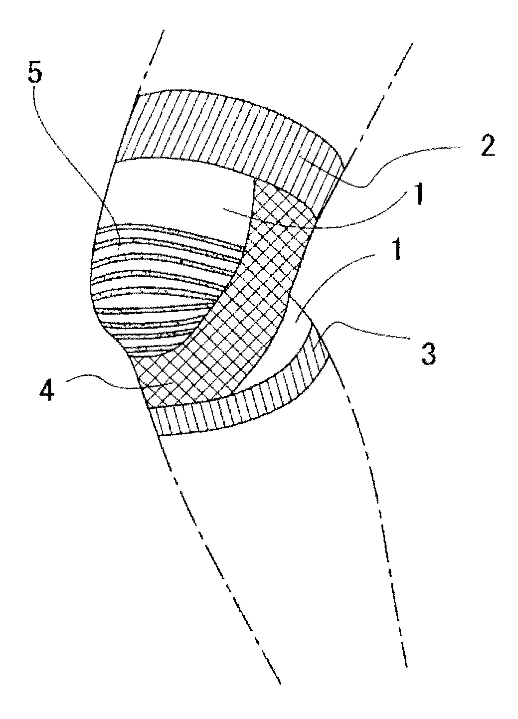 Knee joint supporter