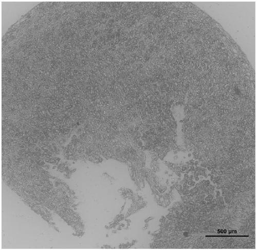 Method for isolating uterine membrane mesenchymal stem cells by dissolving menstrual red blood cells with tea saponin