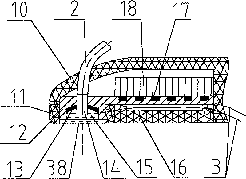 Retaining type ultrasonic treatment gun and ultrasonic beauty treatment equipment containing the treatment gun