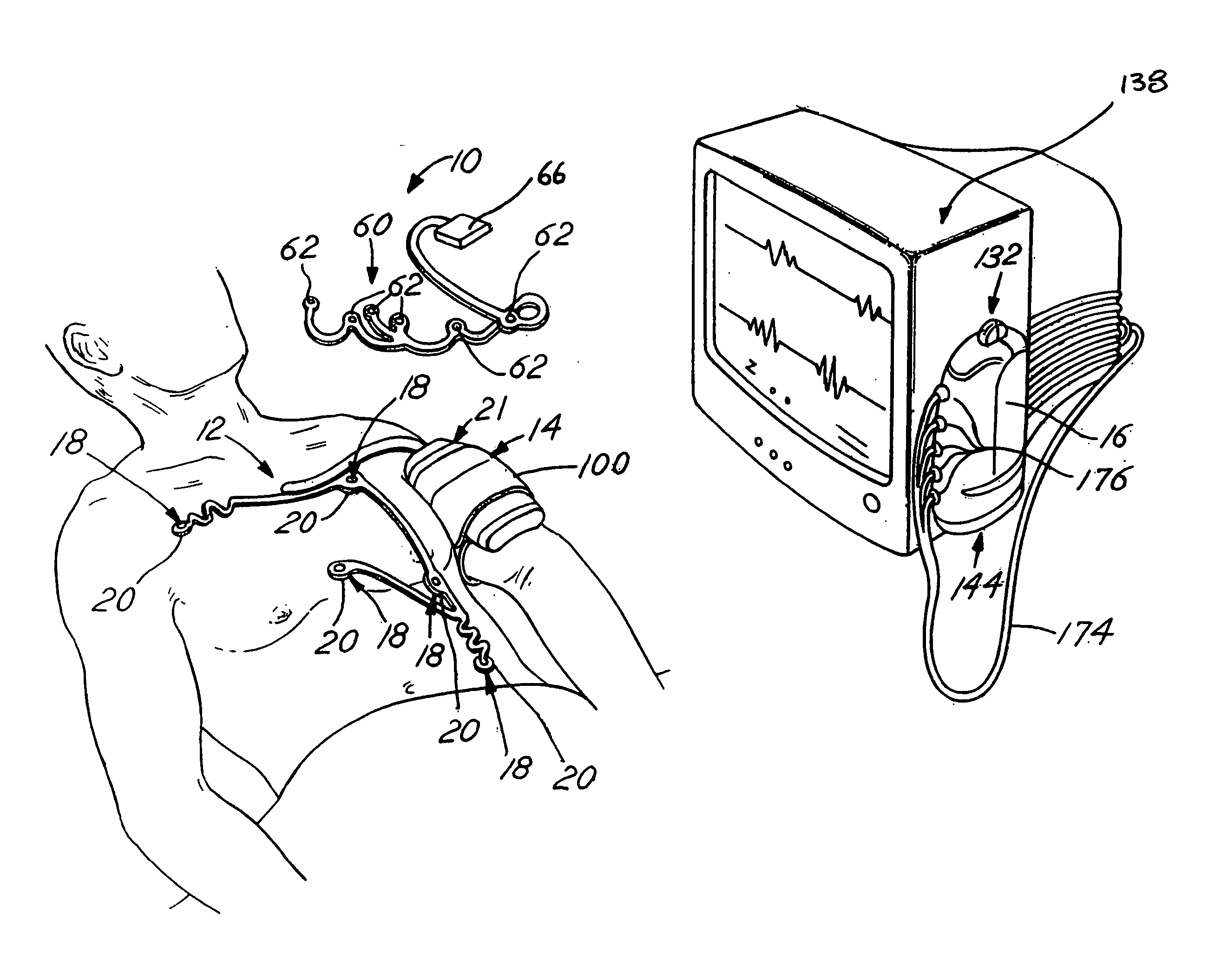 Radiolucent chest assembly