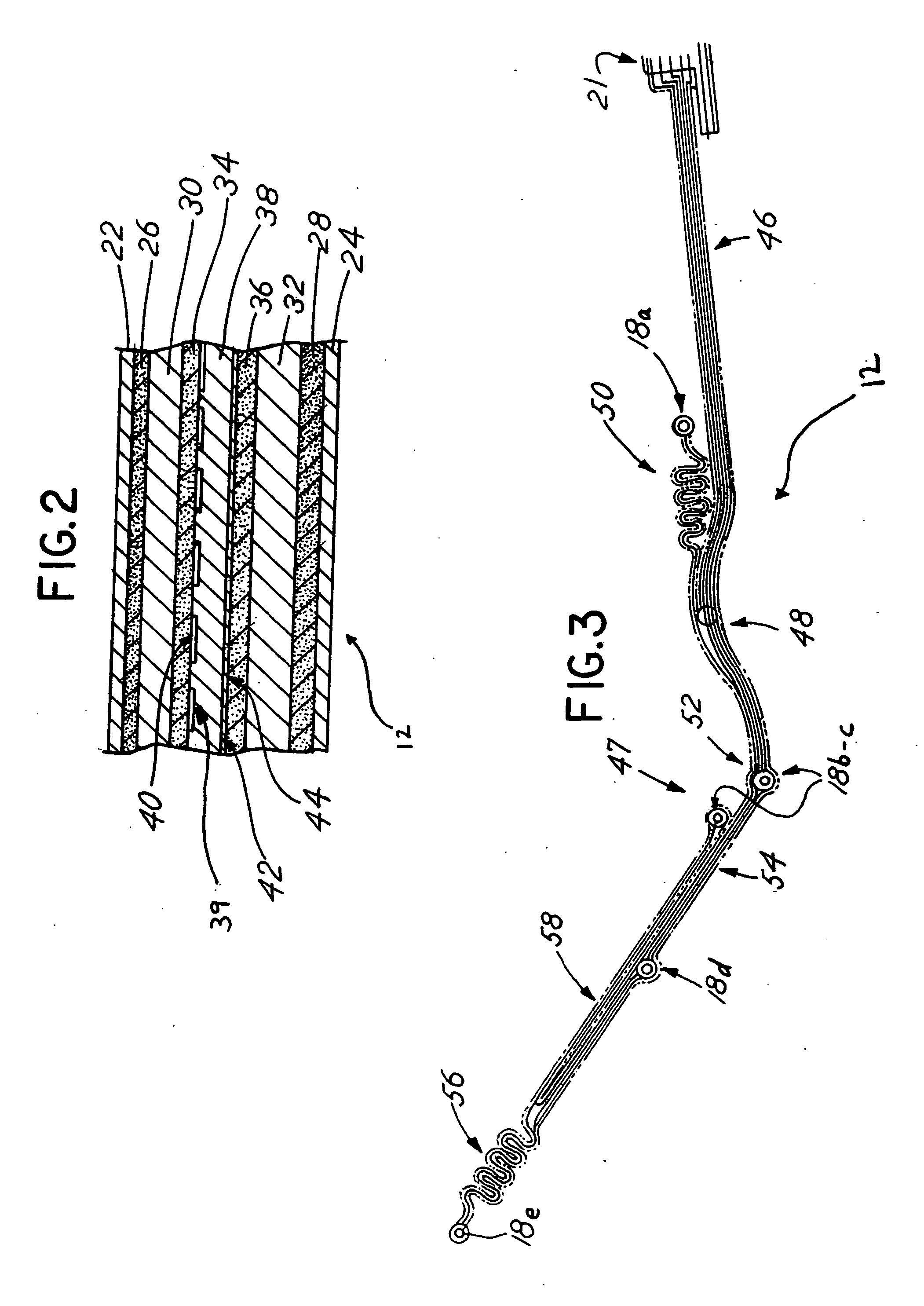 Radiolucent chest assembly