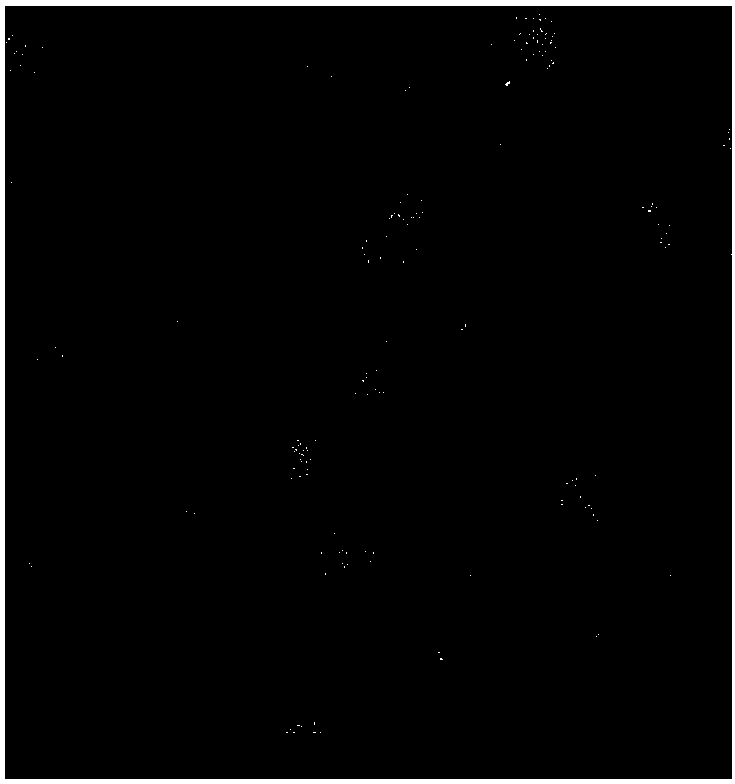 Preparation method of octreotide acetate microspheres