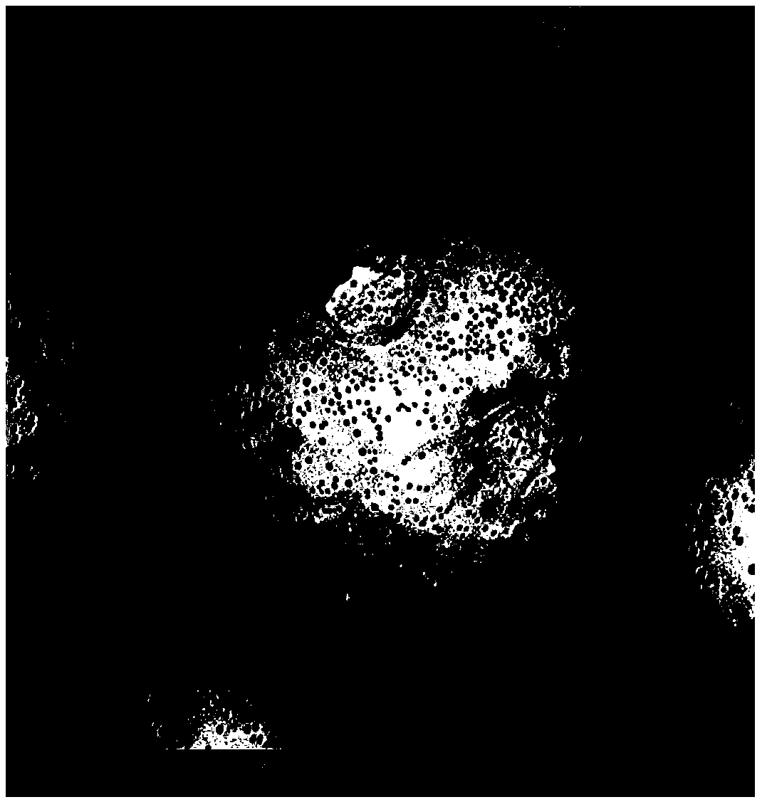 Preparation method of octreotide acetate microspheres