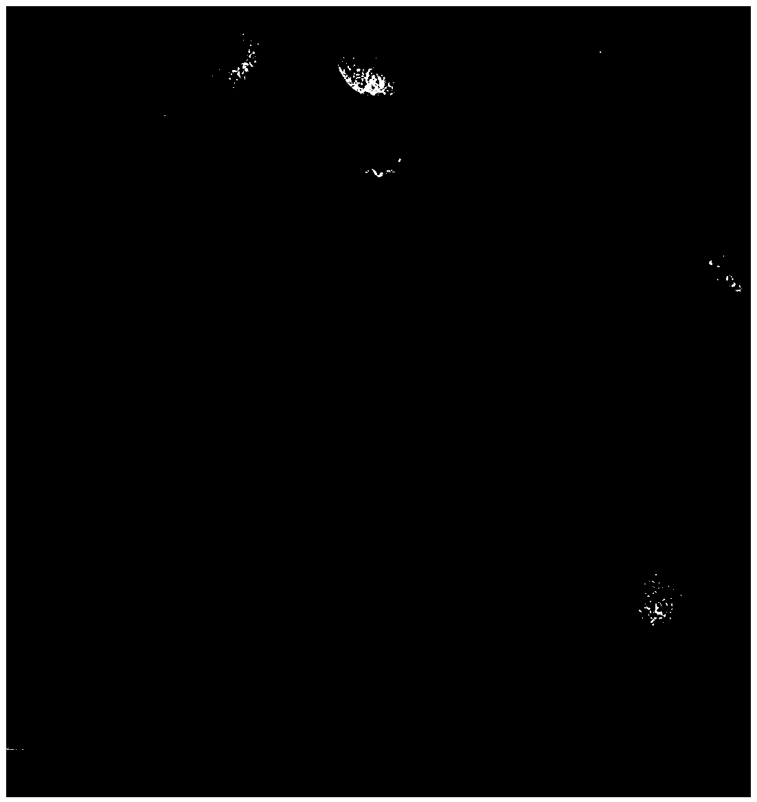 Preparation method of octreotide acetate microspheres