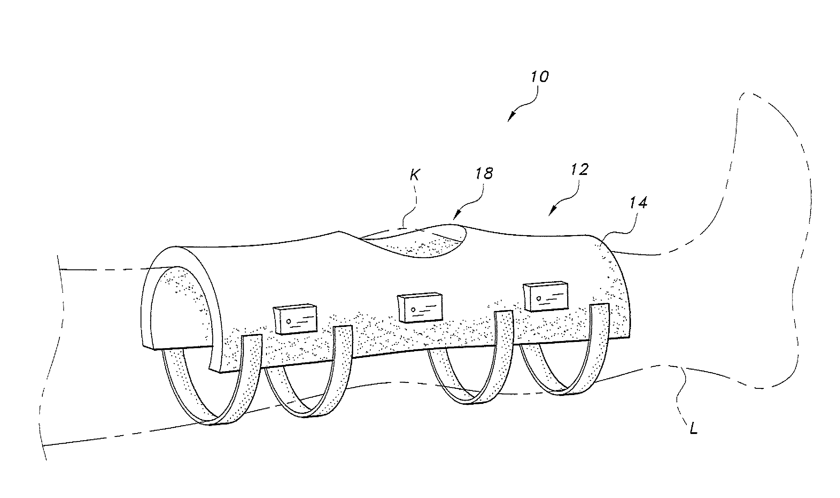 Magnetorheological medical brace