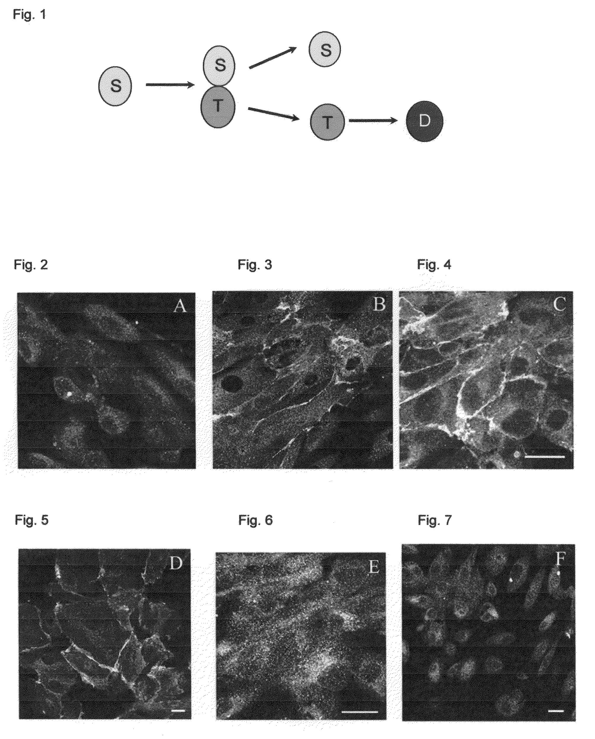 Human renal stem cells