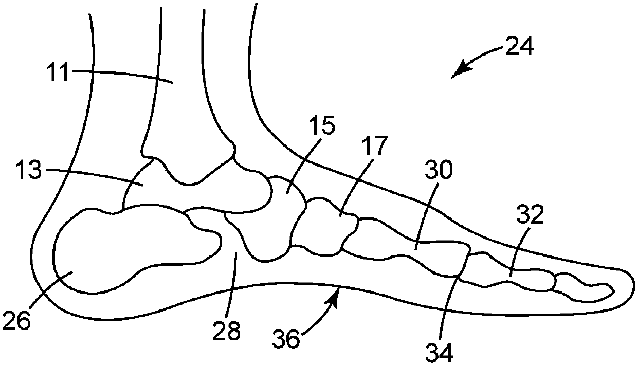 Plantar Fascia Support System