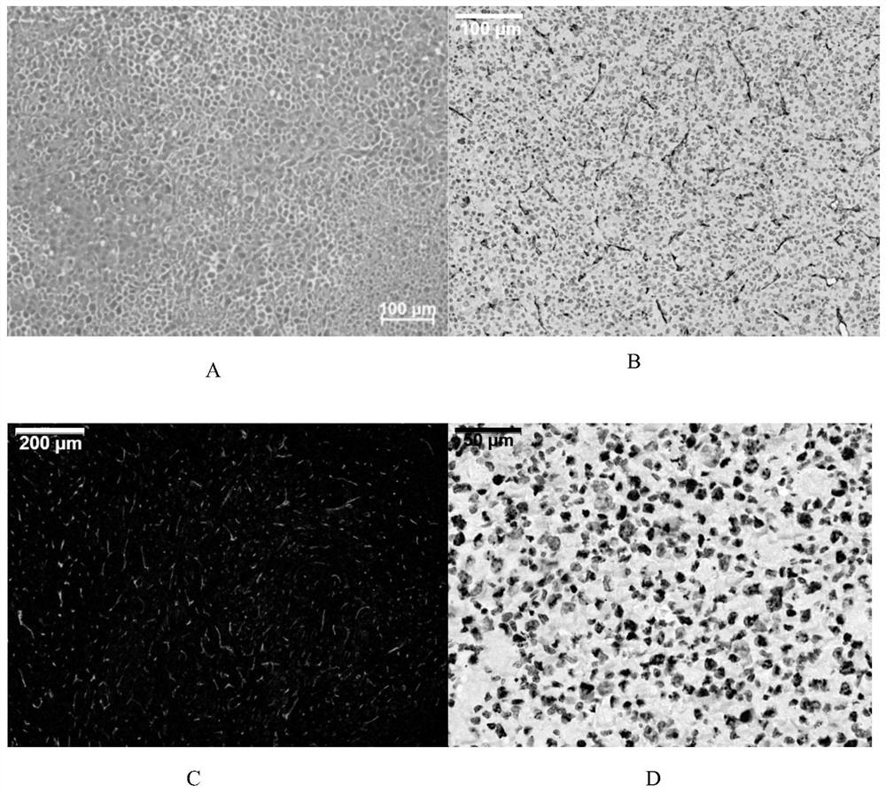 A human hemangioma animal model and its high success rate construction method