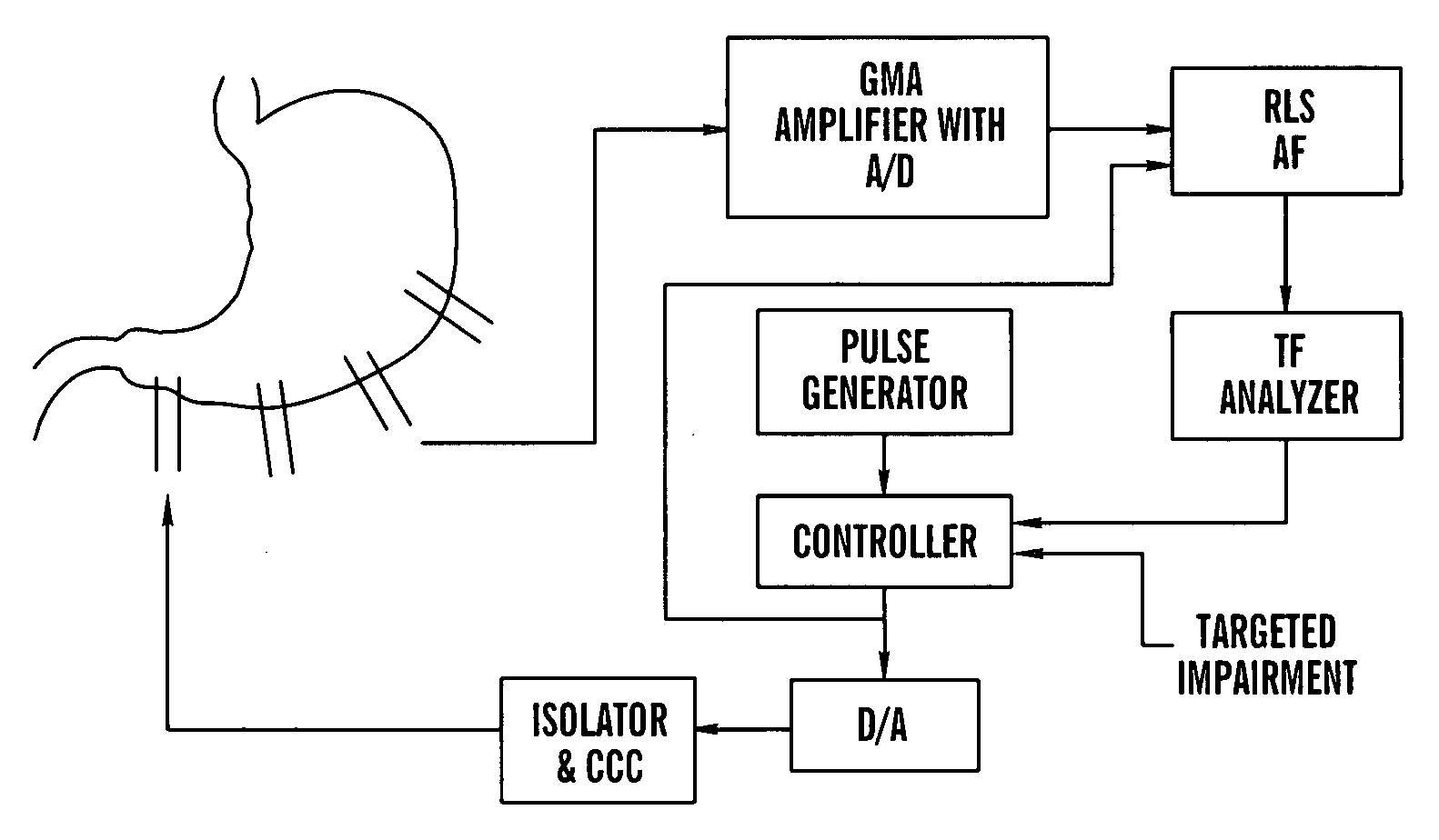 Gastrointestinal electrical stimulation