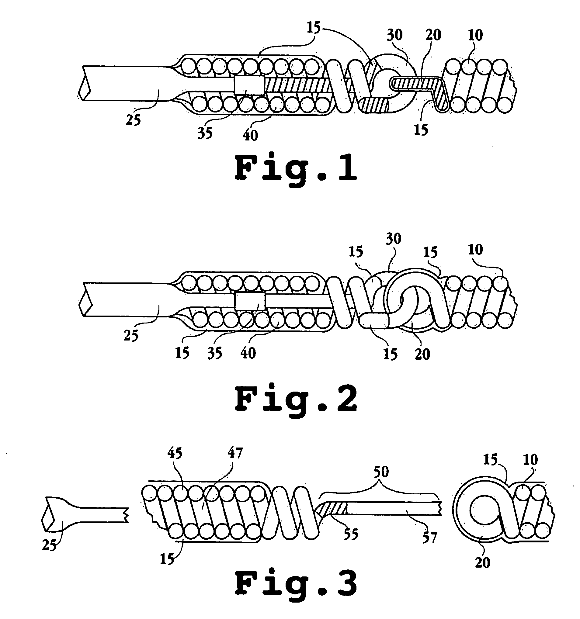 Electrolytically detachable implantable devices