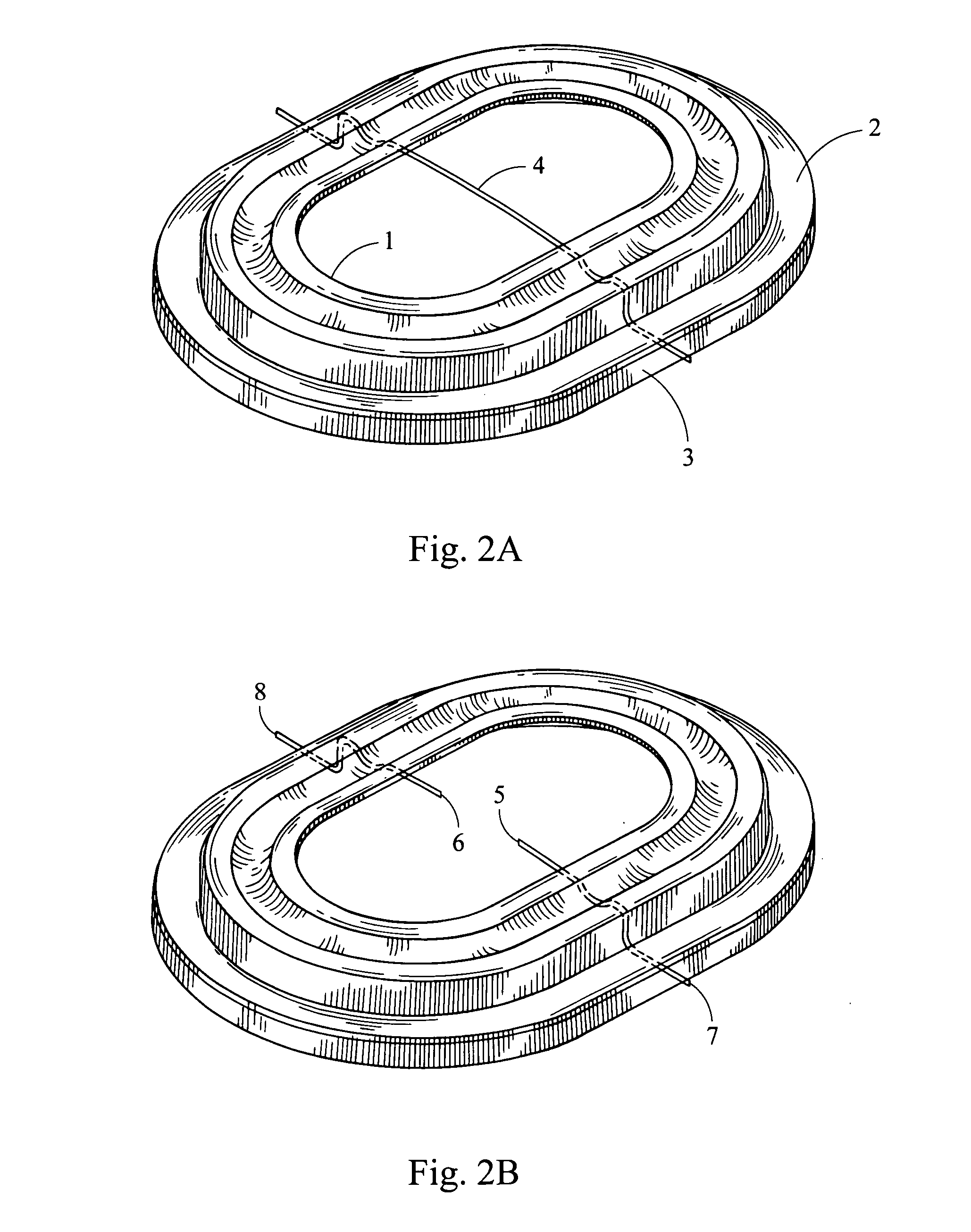 Insert molded surround with mechanical support