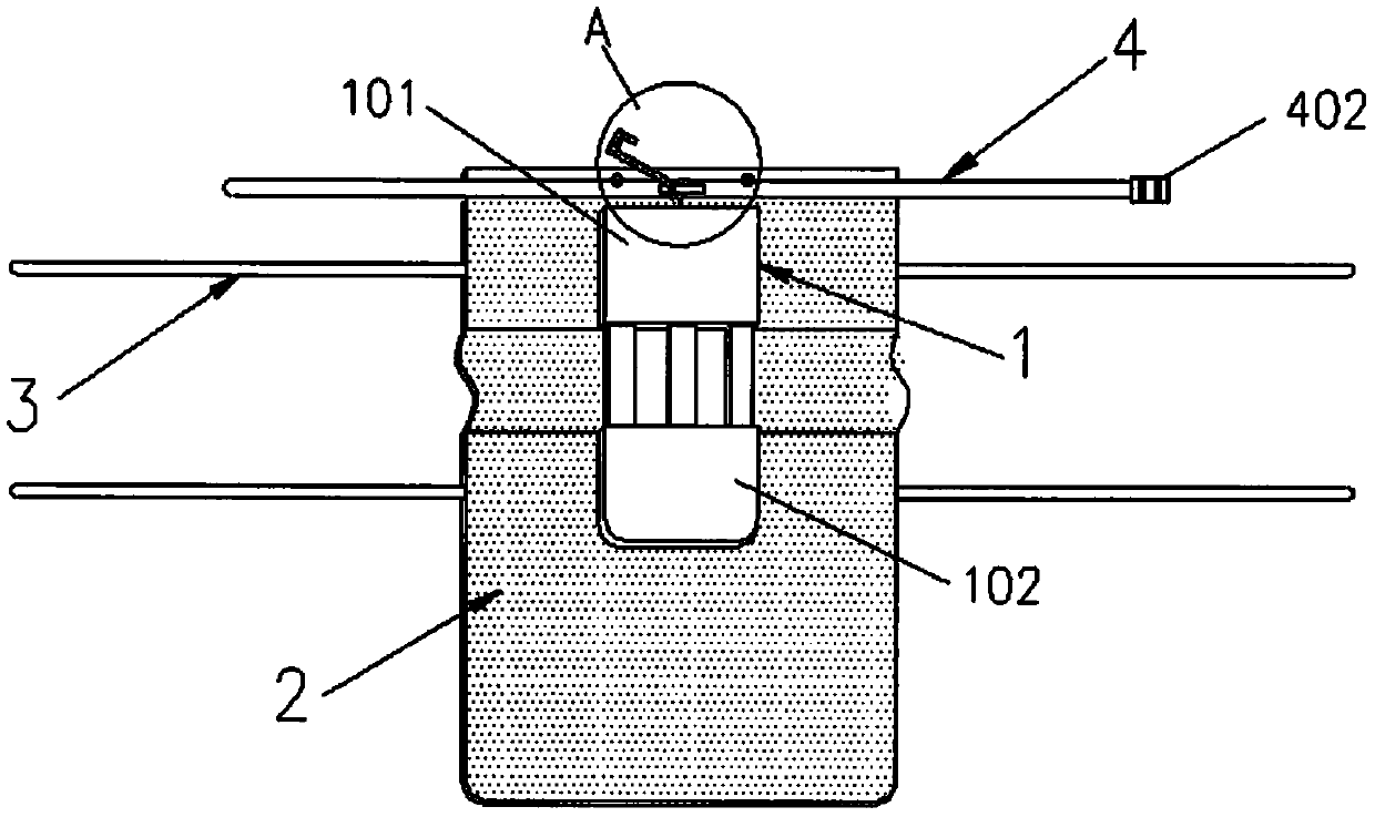 First-aid quick bandage-fixing device for destructive injury of limbs and open fractures