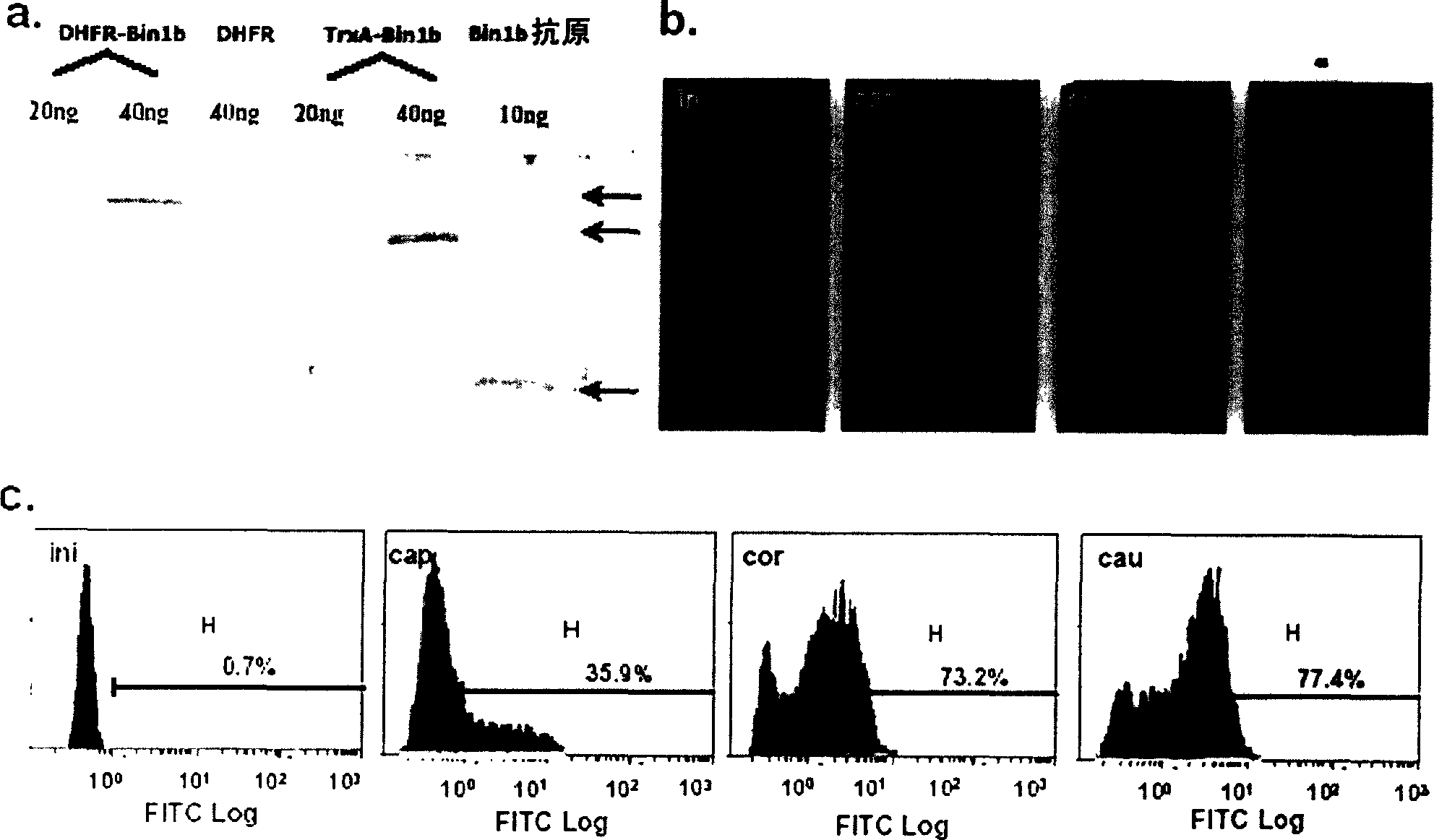 Purposes of epididymis characteristic antibiotic peptide Bin1b in spermiotiliosis