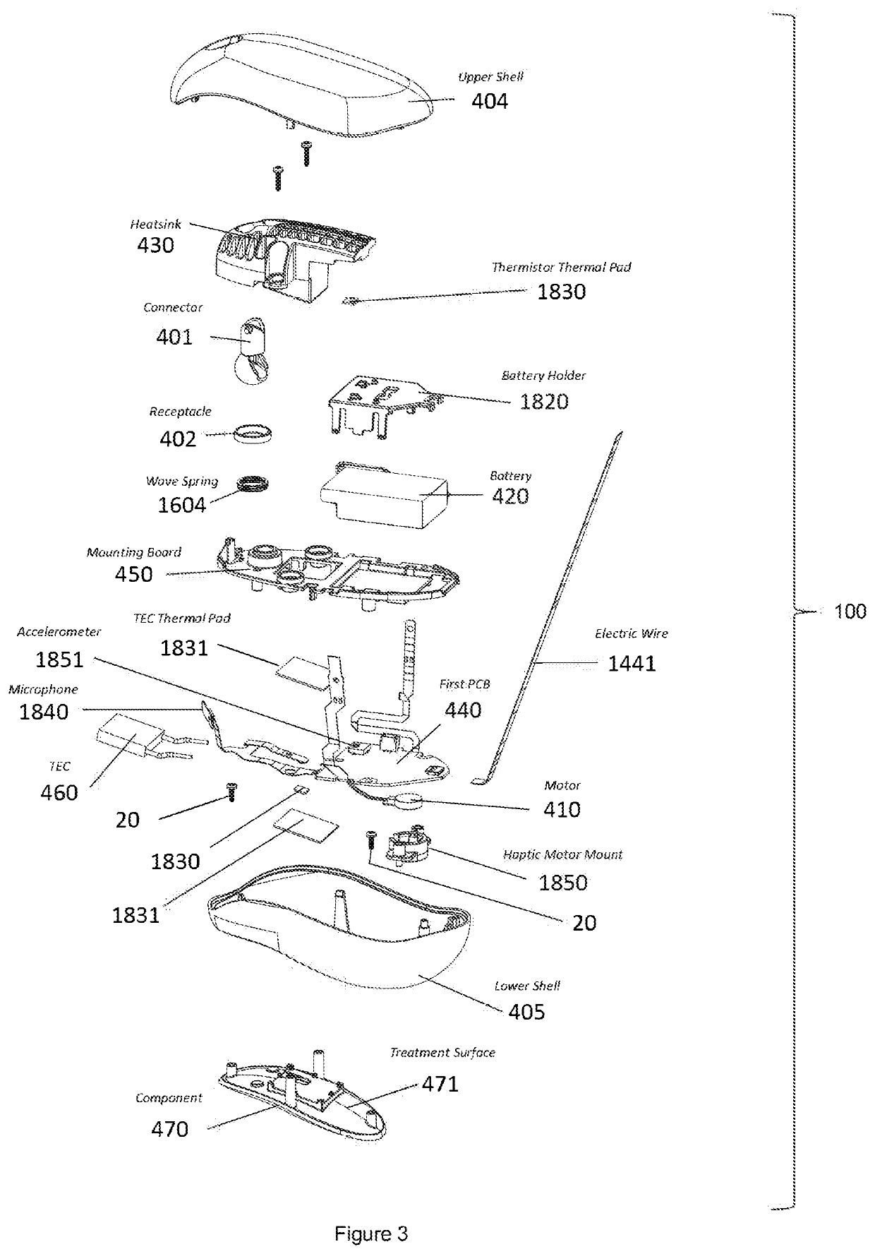 Methods and apparatuses for sensing and relieving stress