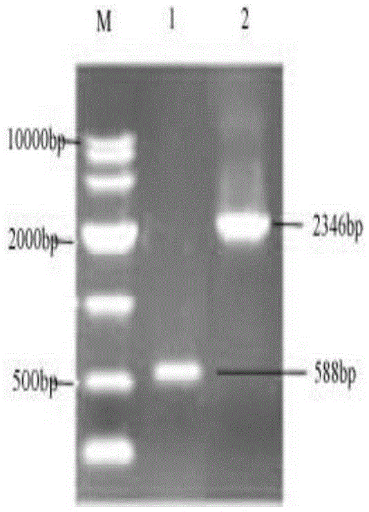 Pichia pastoris gene engineering bacteria for recombinant expression of human glutamic acid decarboxylase