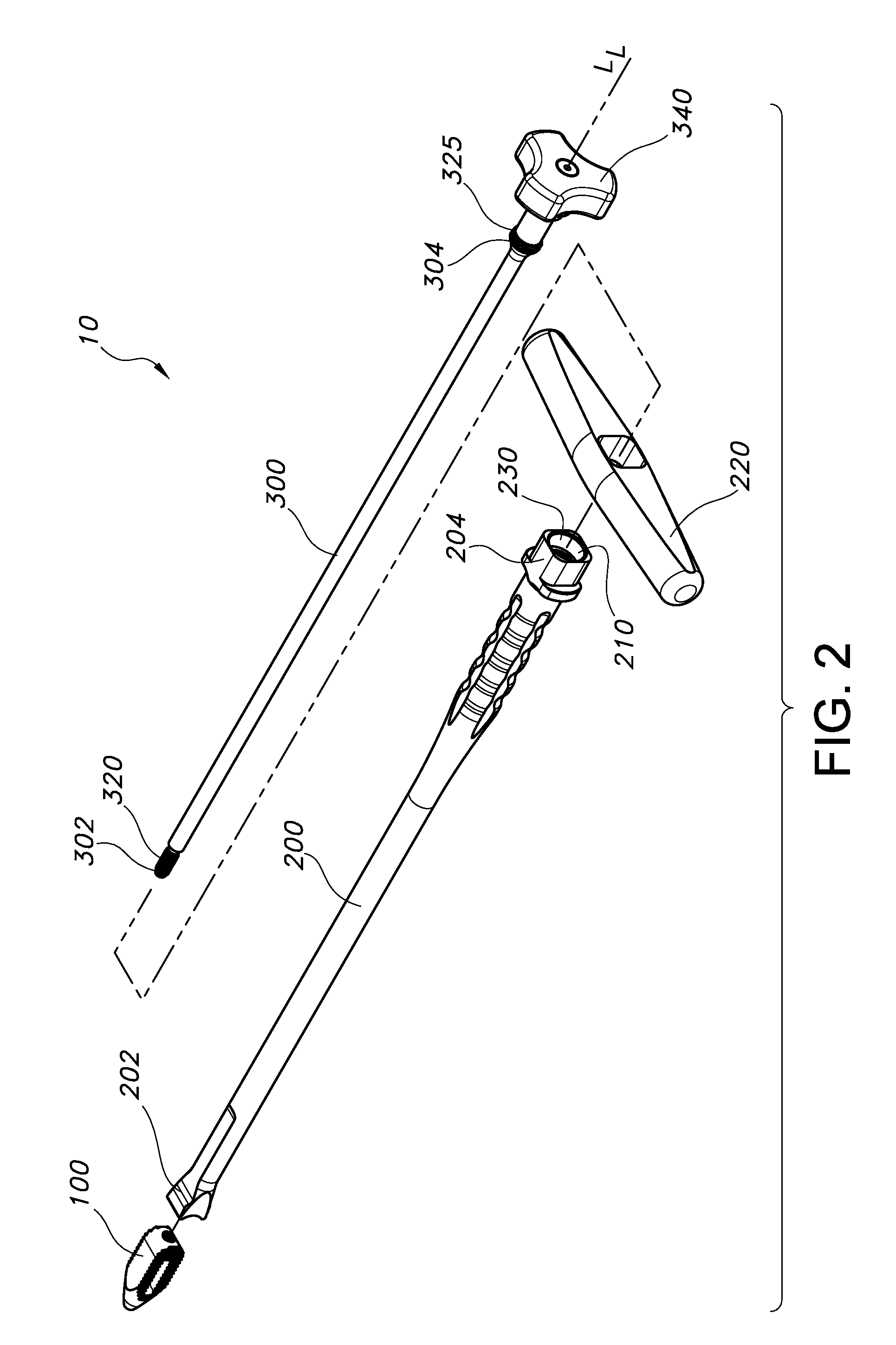 Percutaneous arthrodesis method and system