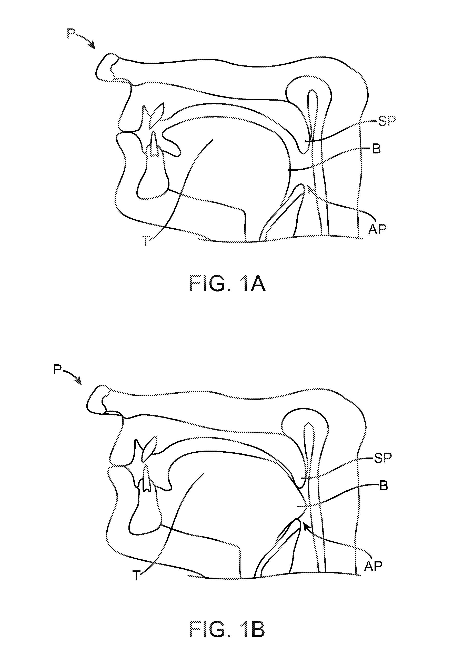 Tongue retention system