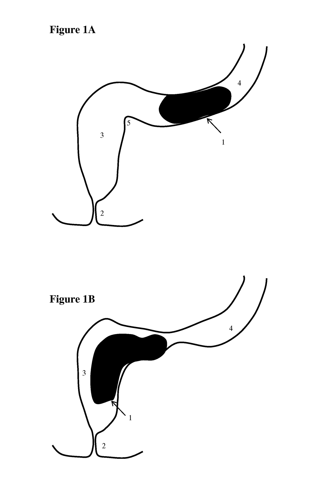 Apparatus for testing distal colonic and anorectal function