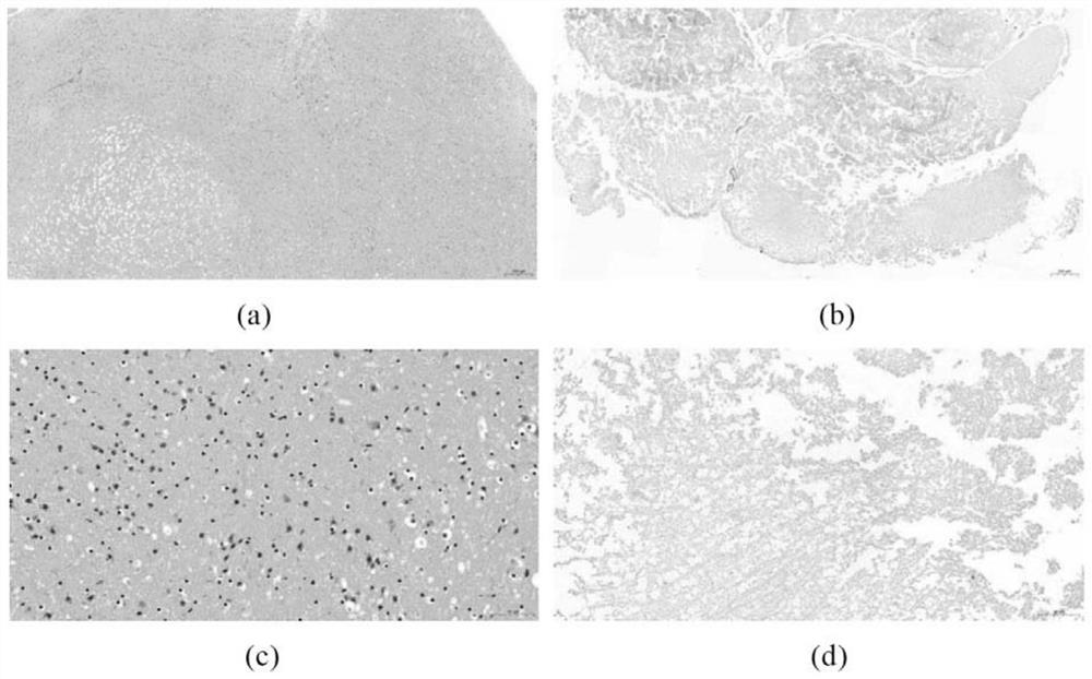 Preparation method of brain acellular matrix