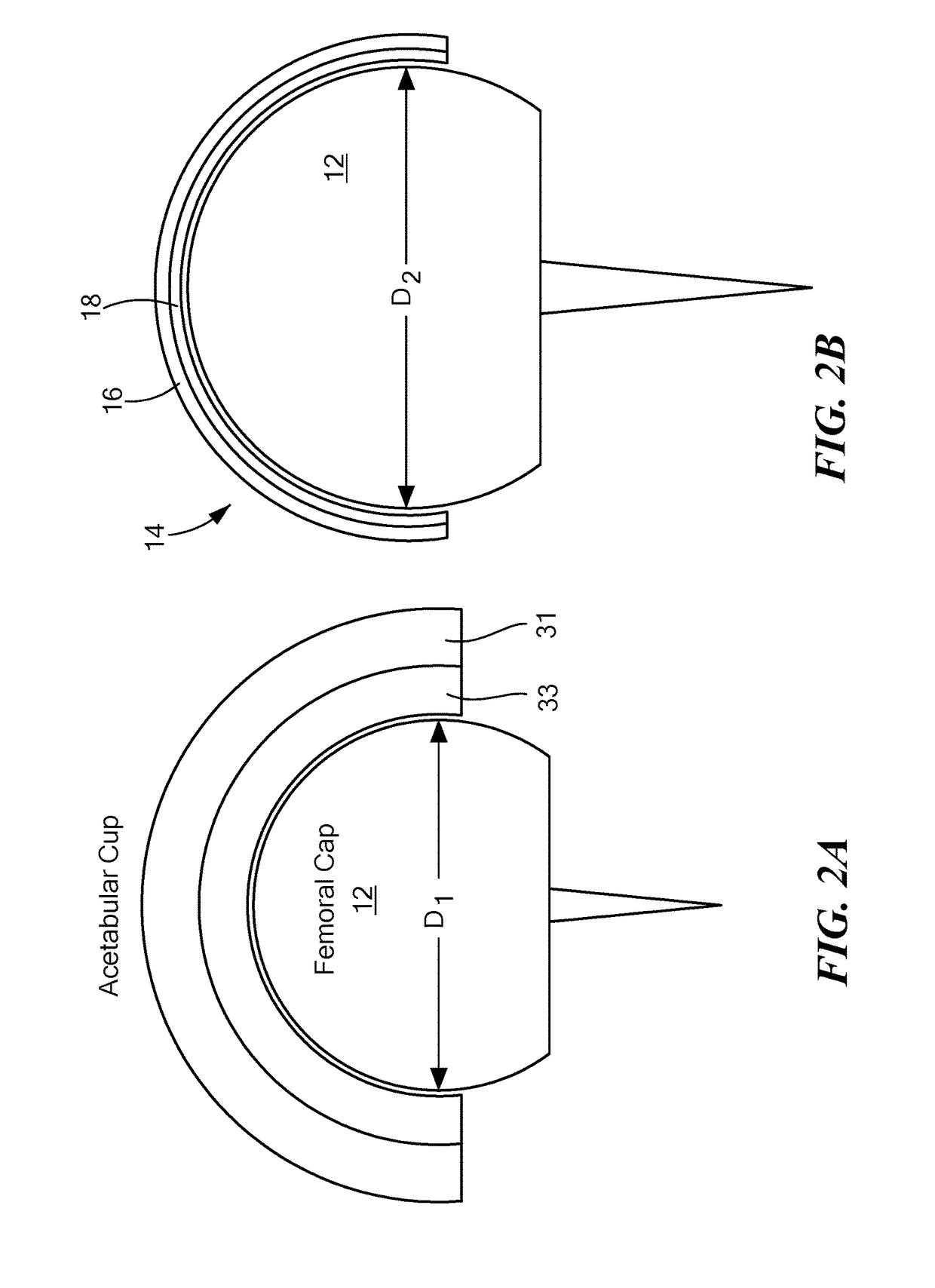 Veterinary hip resurfacing prosthetic system