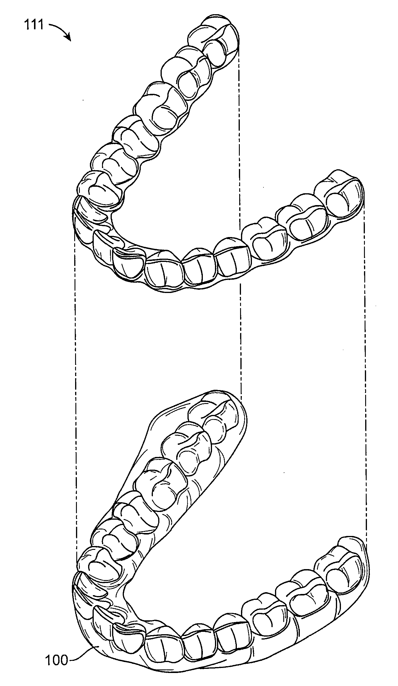 Tooth movement measurement by automatic impression matching