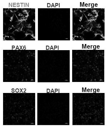 A preparation method and application of oligodendrocytes