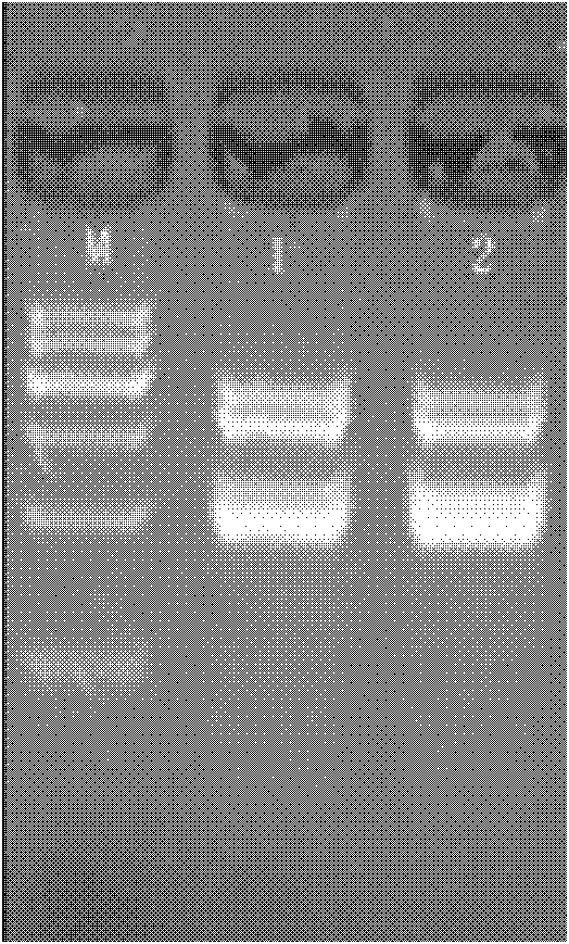 Respiratory virus detection kit and detection method