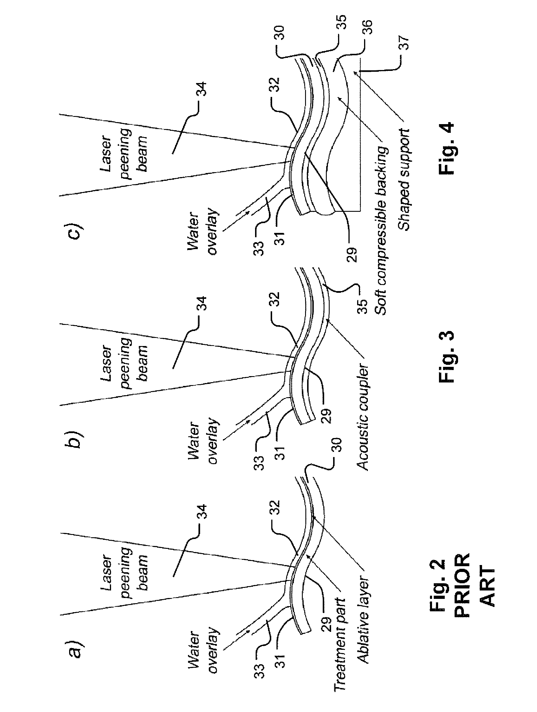 Laser shock processing with momentum trap