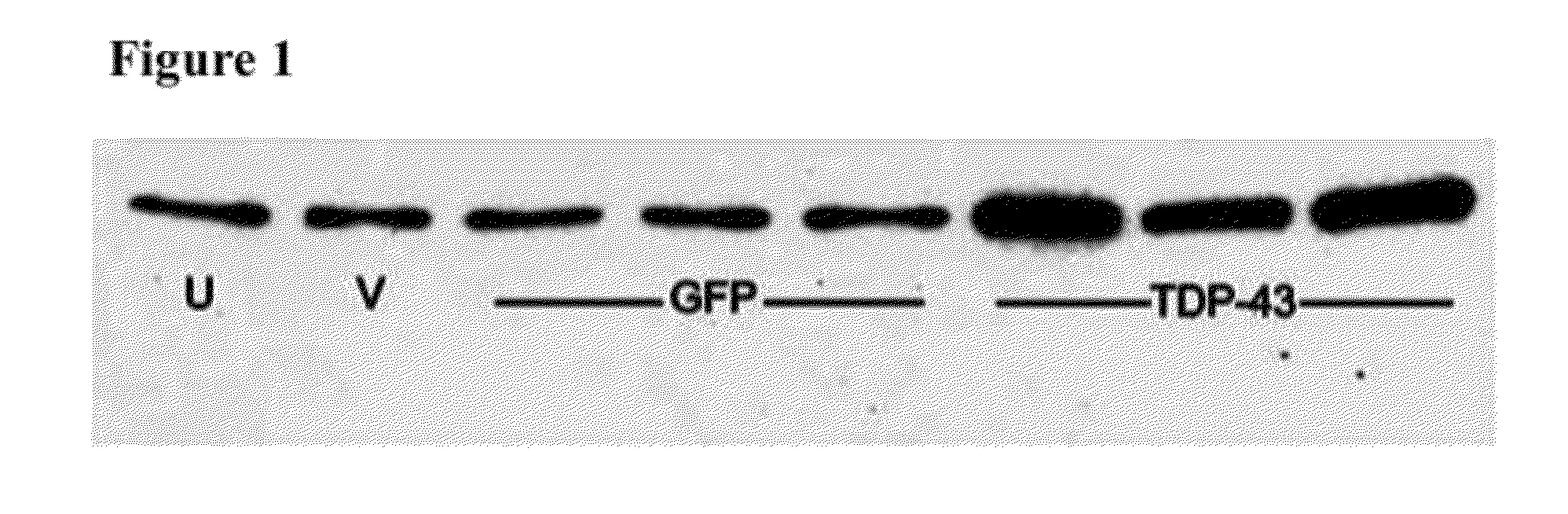 Assays of Neurodegenerative Disorders, including Frontotemporal Dementia and Amyotrophic Lateral Sclerosis